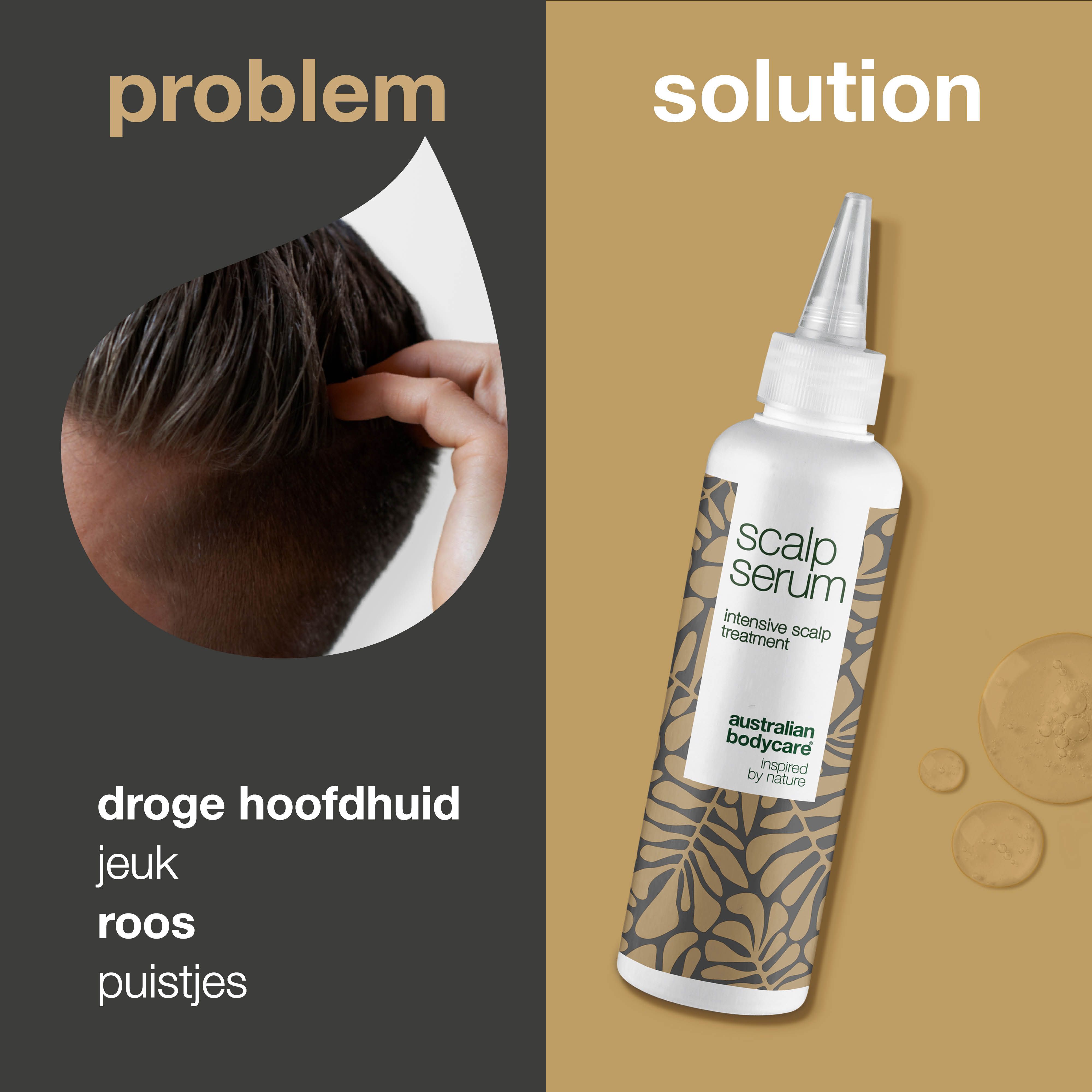 Grafiek: probleem en oplossing. Droge hoofdhuid, jeuk, roos, puistjes. Flesje: Scalp Serum.
