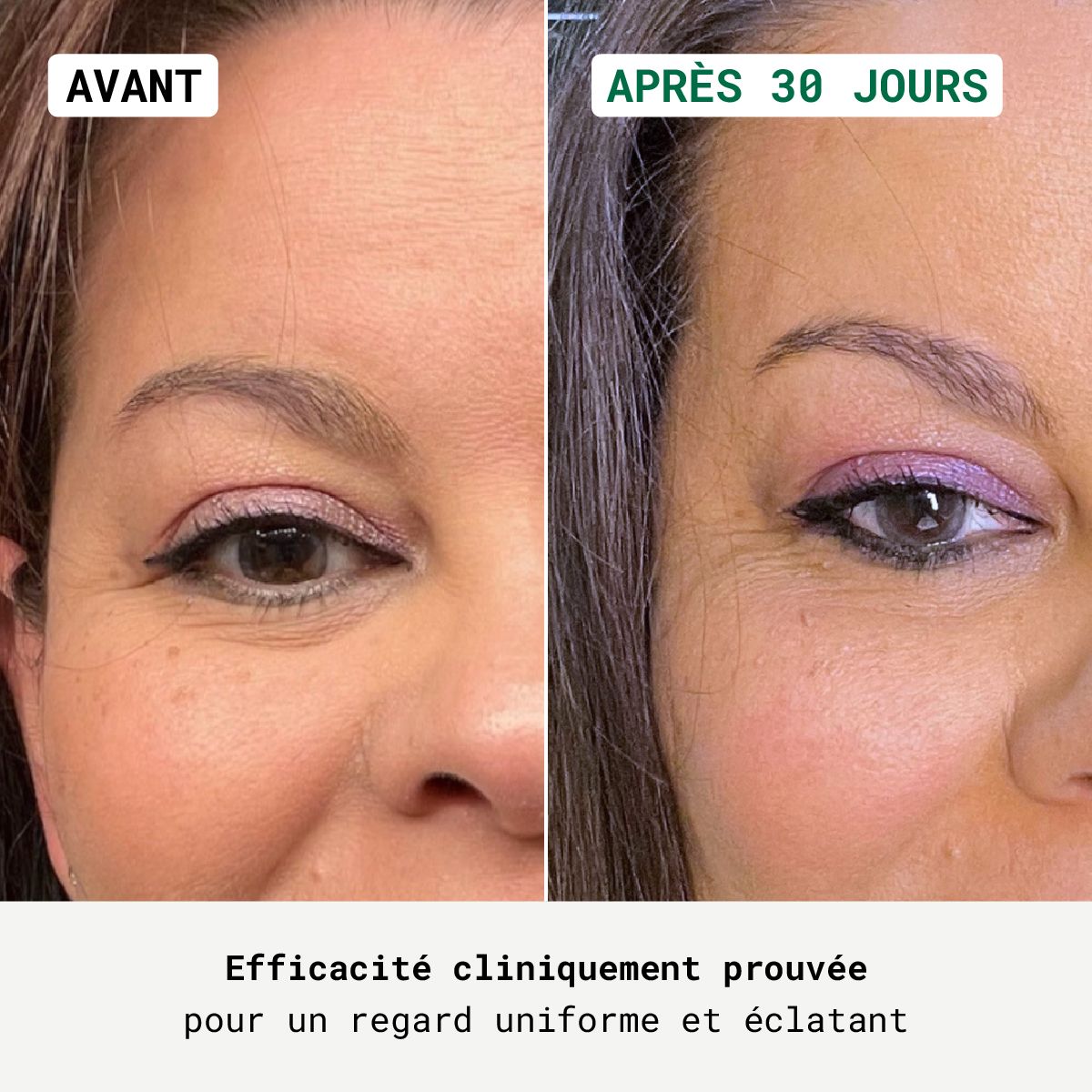 Voor-en-na vergelijking. Opschrift: Klinisch bewezen effectiviteit. Oogcontour.