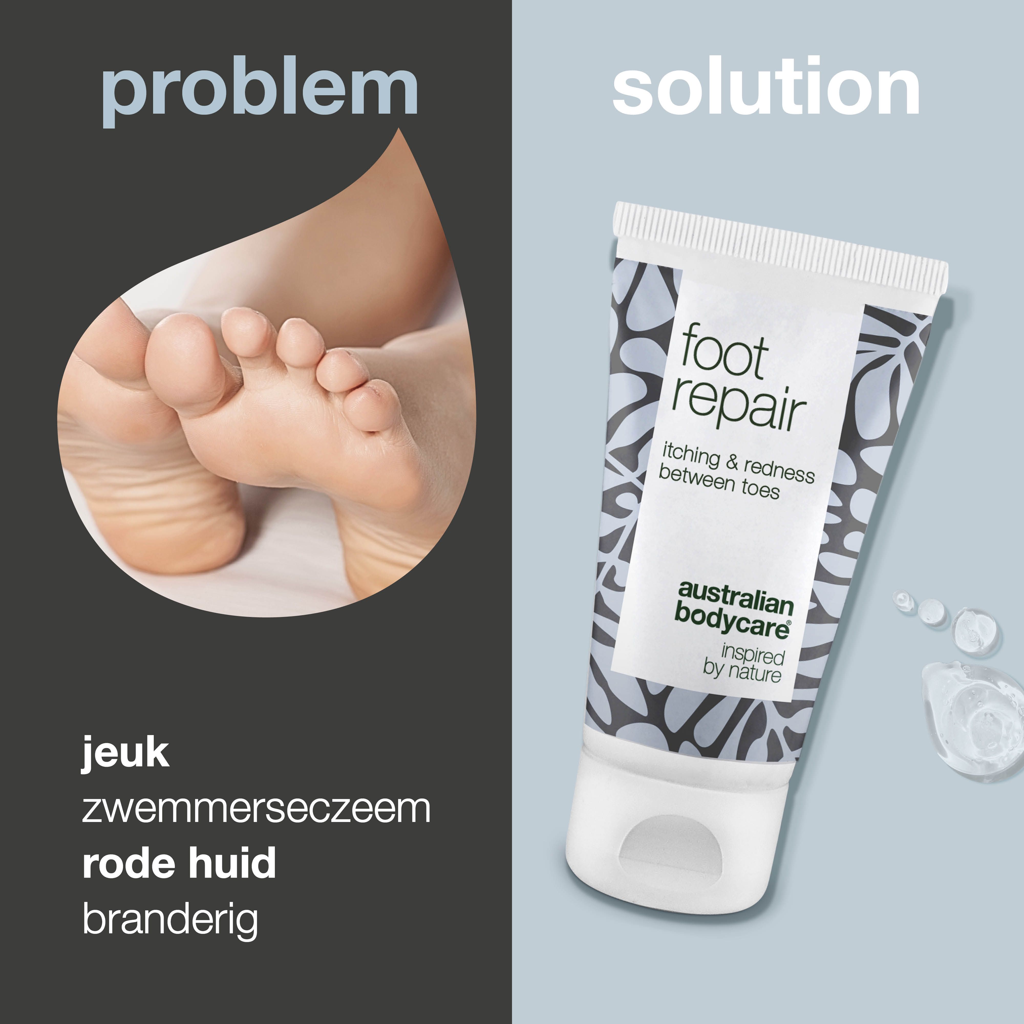 Voet met jeuk, branderigheid, roodheid. Voetverzorging tube: foot repair, itching & redness between toes, Australian Bodycare.
