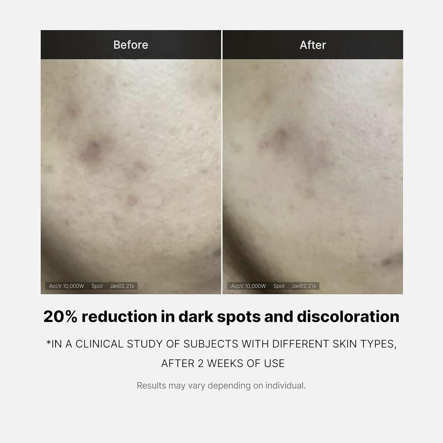 Voor-en-na vergelijking van de huid. Tekst: 20% vermindering van donkere vlekken. Studie na 2 weken. Resultaten variëren.