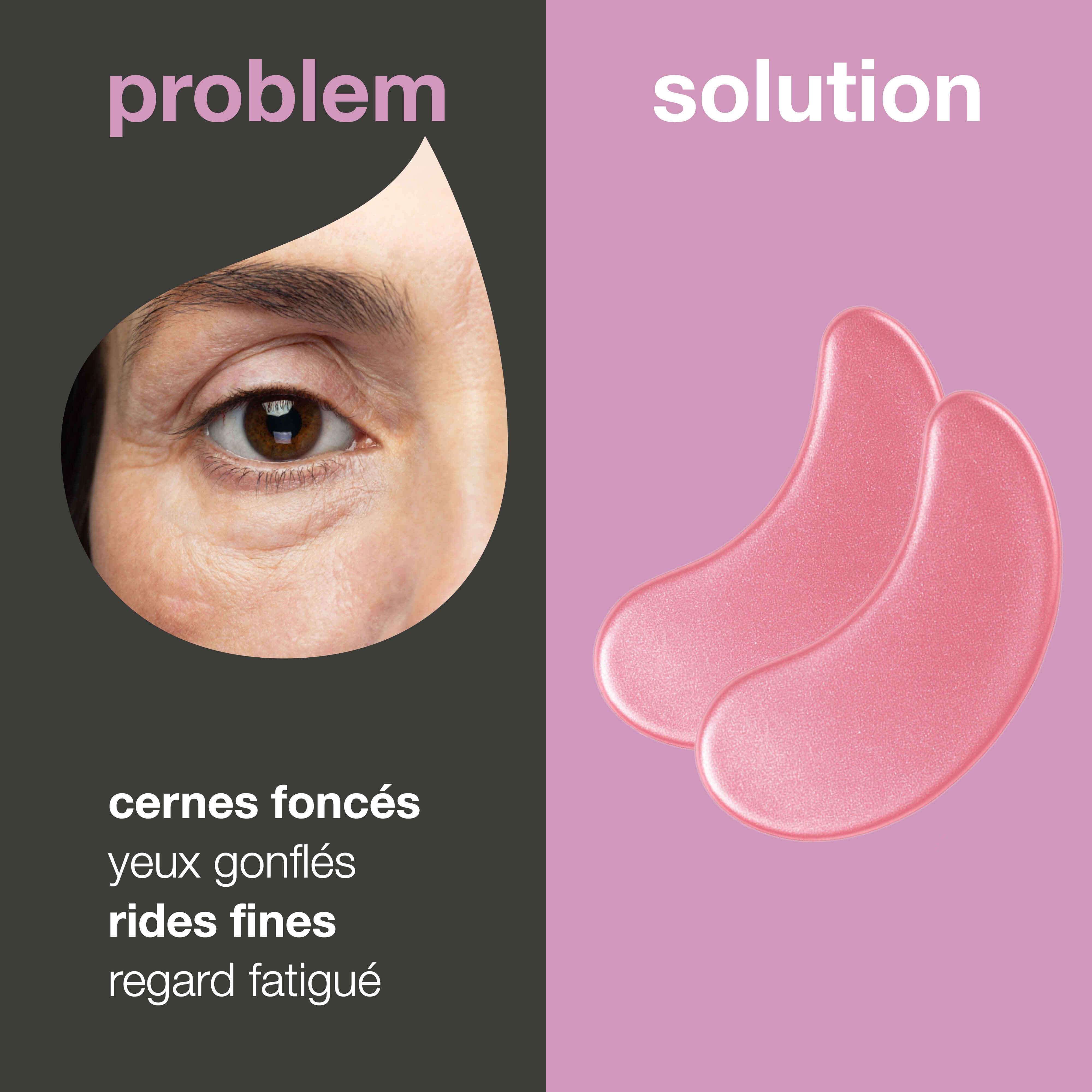 Comparaison d'un contour des yeux avec cernes et masques pour les yeux. Inscription : Problème, Solution. Masques pour les yeux roses.