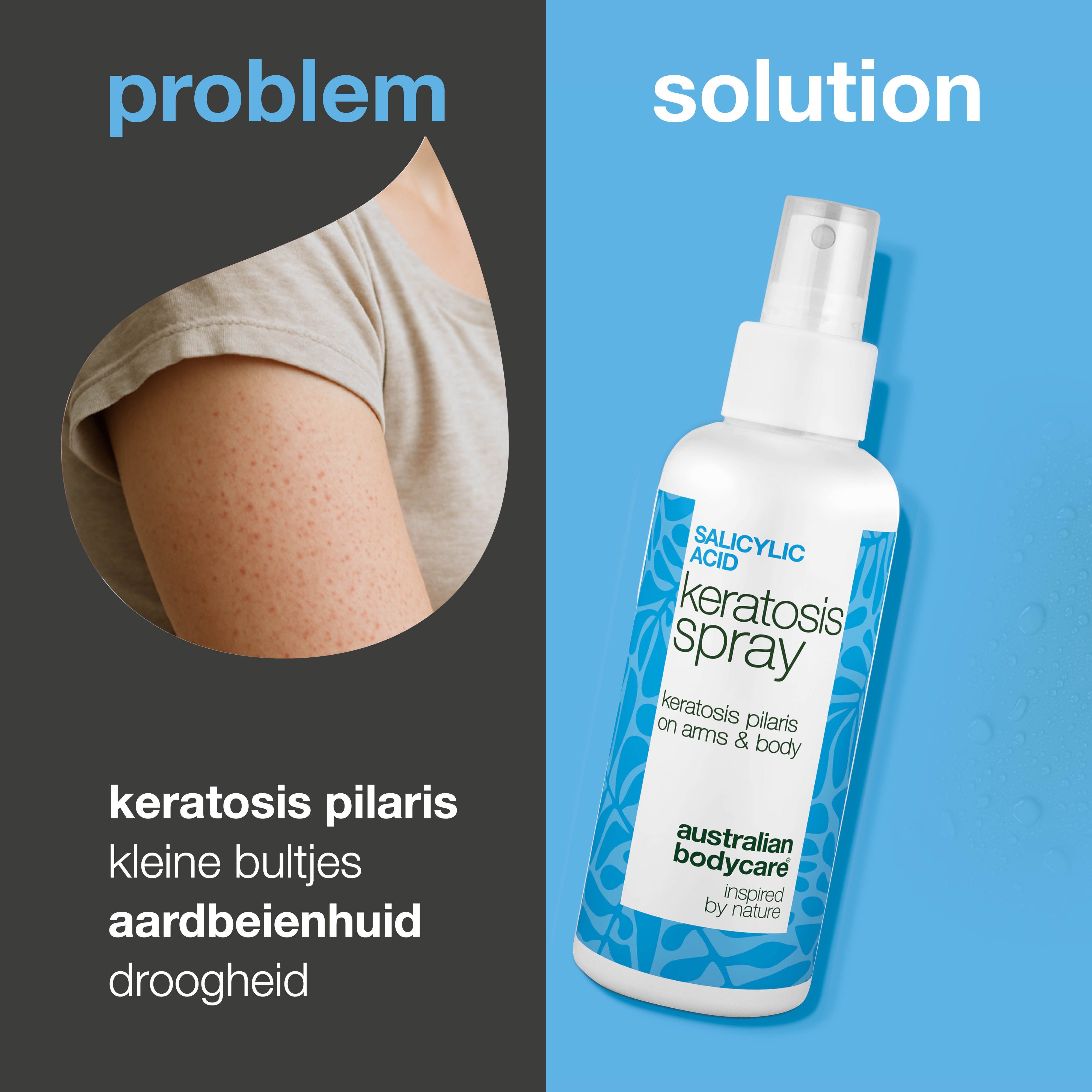 Arm met huidonzuiverheden. Daarnaast spray: Keratosis Spray, Australian Bodycare. Teksten: probleem, oplossing.