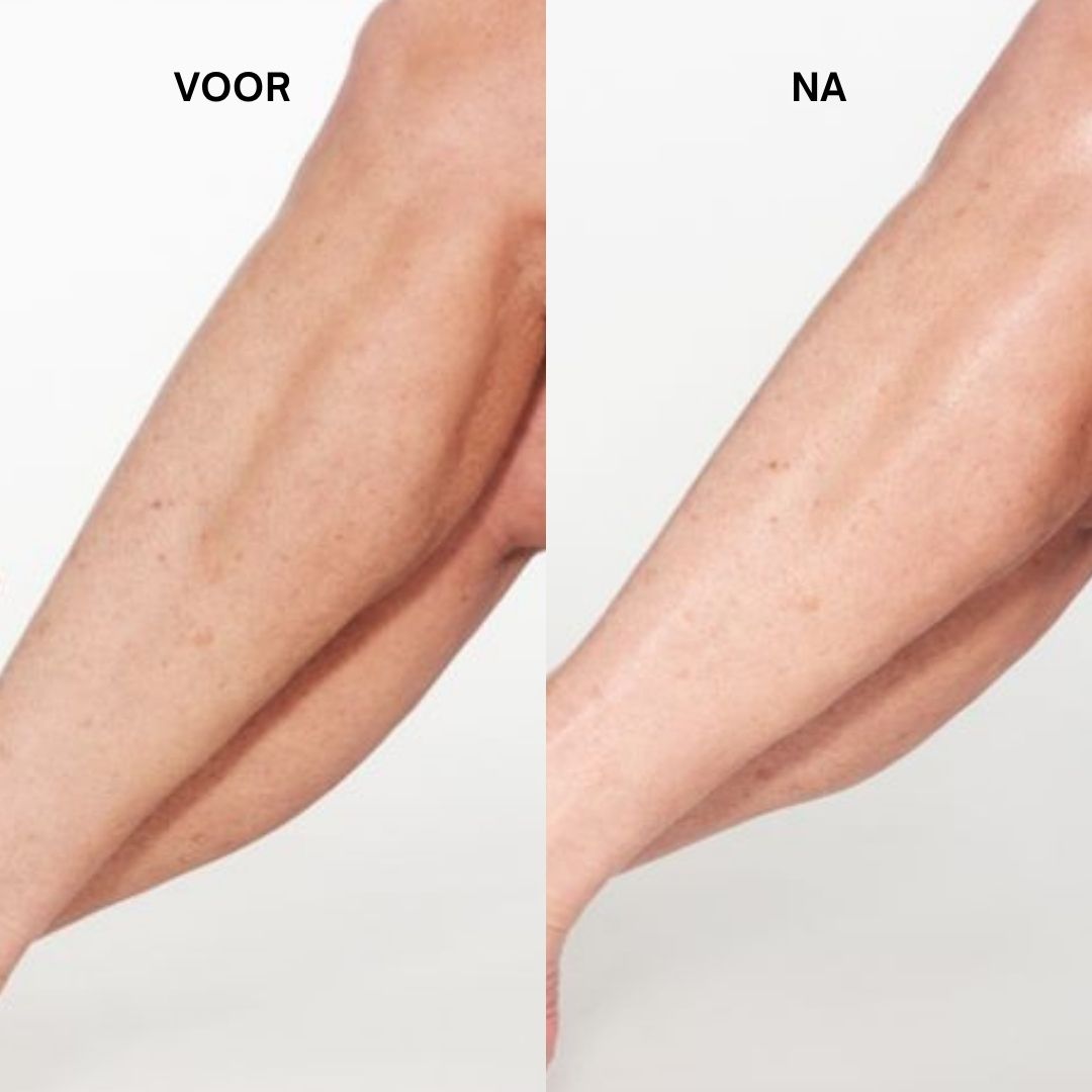 Benen voor en na gebruik. Huid ziet er gladder en gehydrateerder uit.