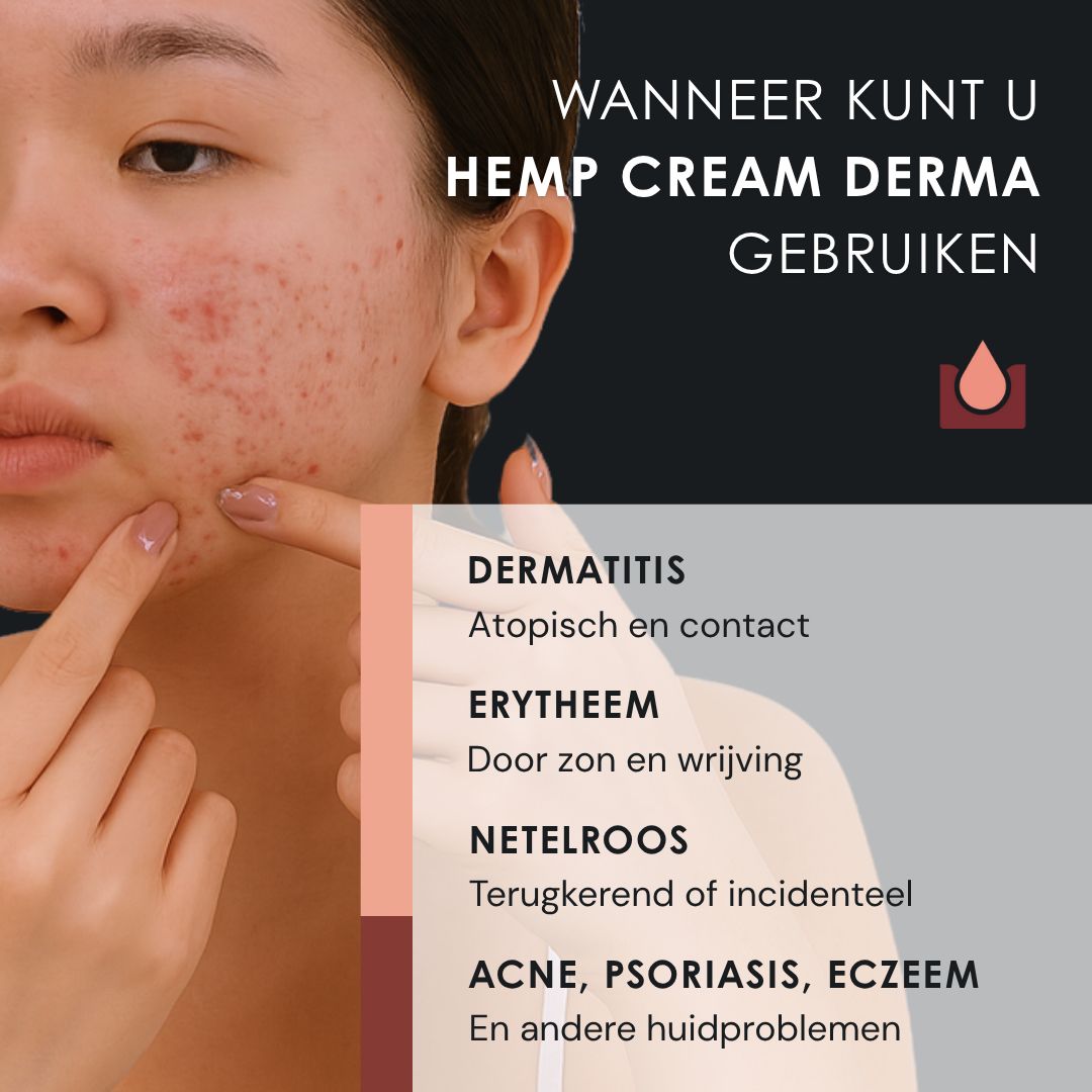 Vrouw raakt haar gezicht aan. Tekst: Wanneer kunt u HEMP CREAM DERMA gebruiken? Tekst: Dermatitis, Erytheem, Netelroos, Acne, Psoriasis, Eczeem.