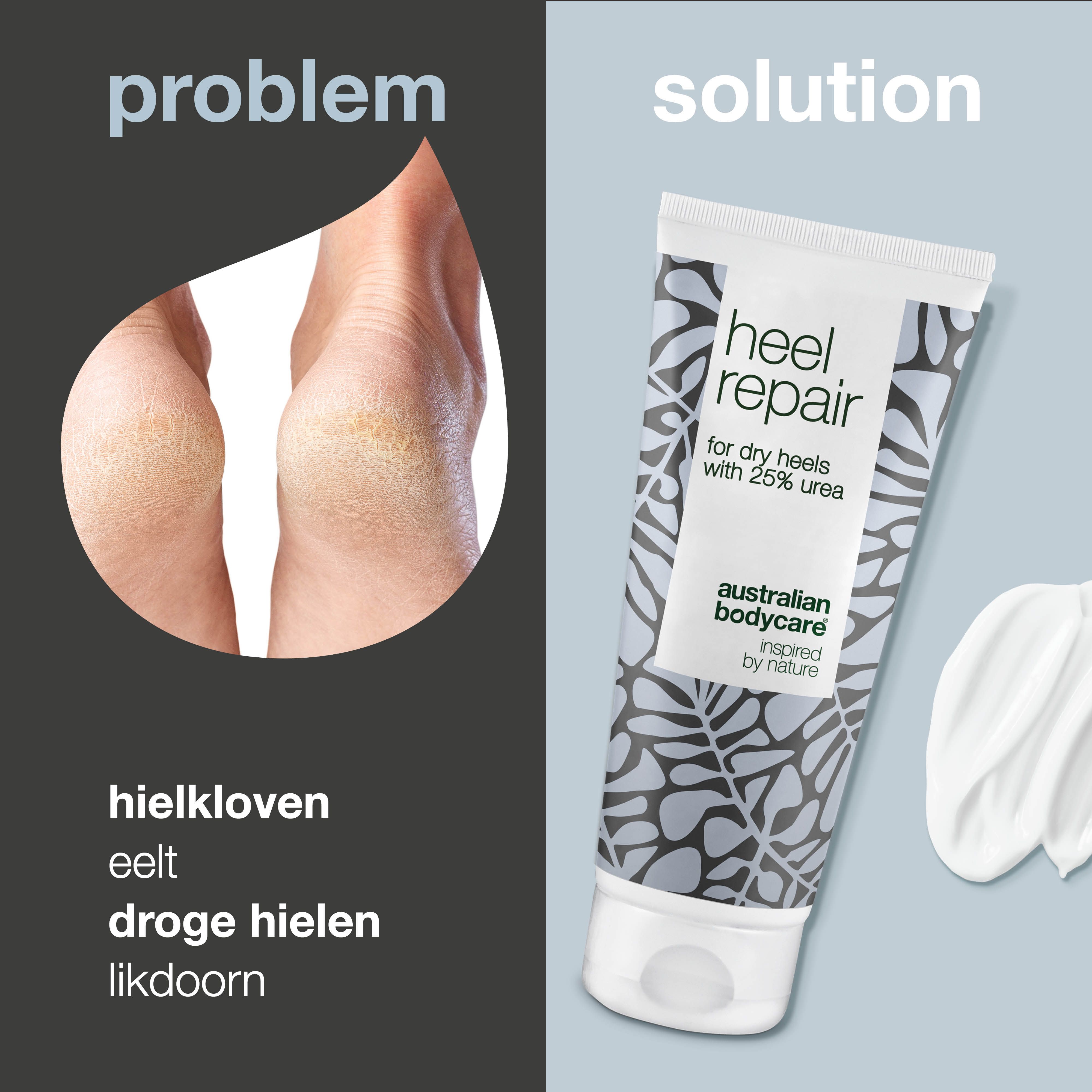 Probleem: gebarsten hielen. Oplossing: Tube Heel Repair, Australian Bodycare. Crème.