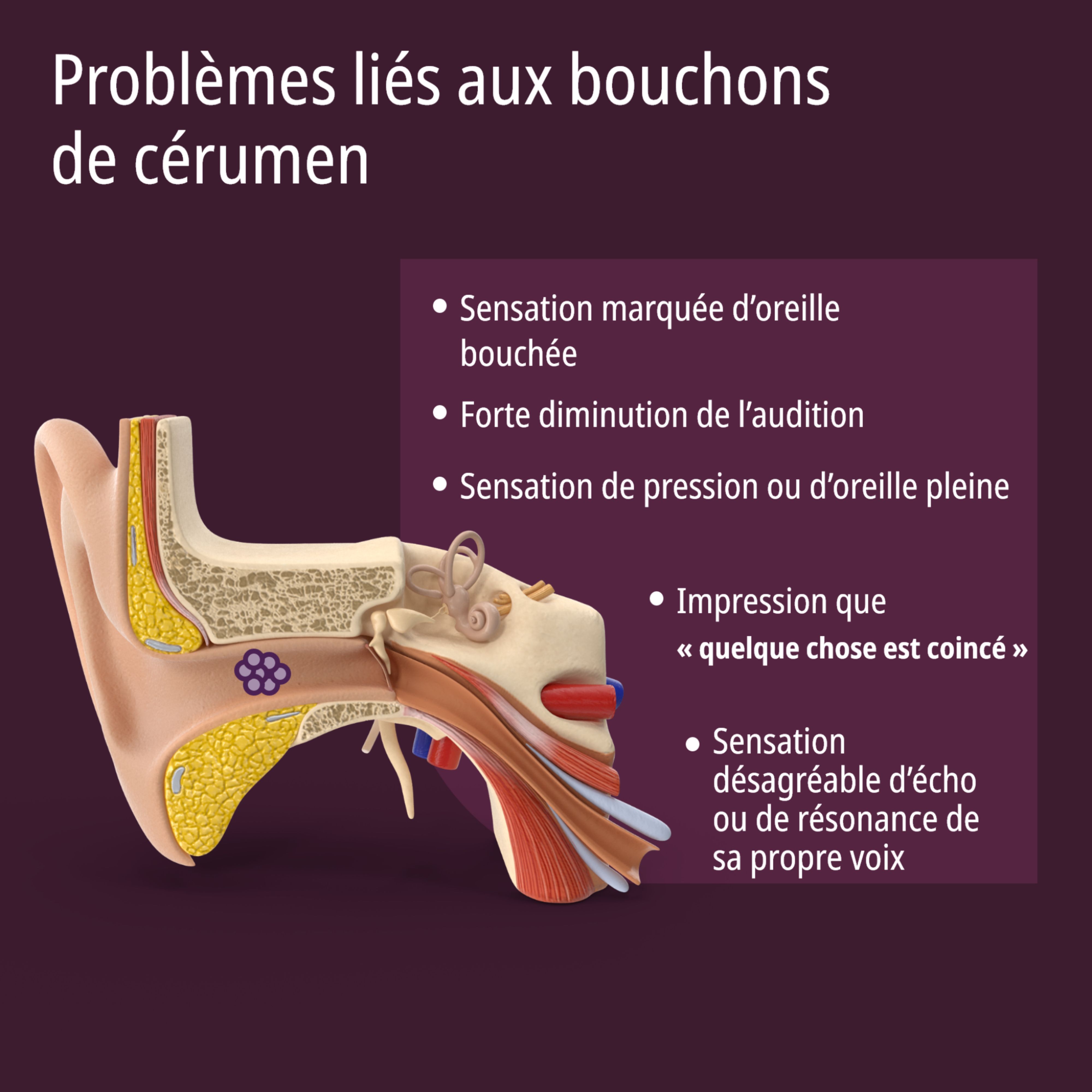 Nettoyeur d'oreilles EVOLSIN® : un set pour toute la famille, aussi pour enfants dès 3 ans.
