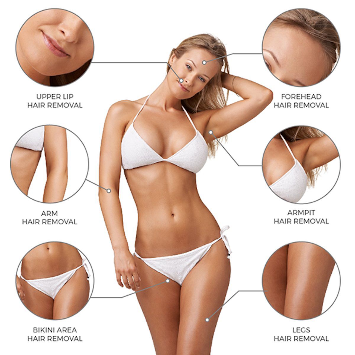 Vrouw in witte bikini, diagram met ontharingsgebieden: bovenlip, arm, oksel, bikinilijn, benen, voorhoofd.