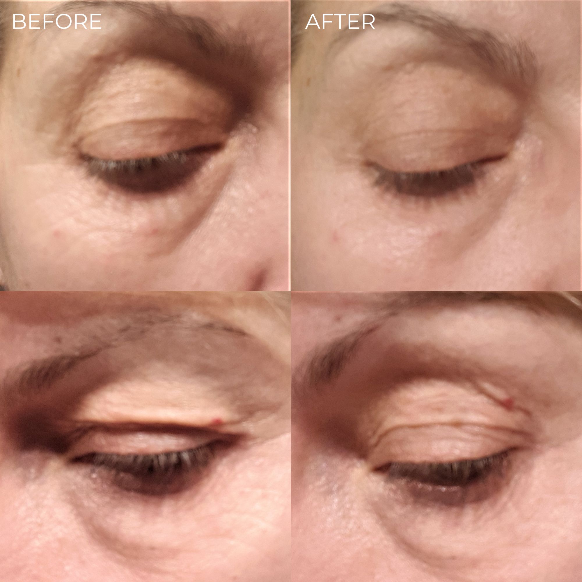 BEAUTICAL Instant Lifting Serum