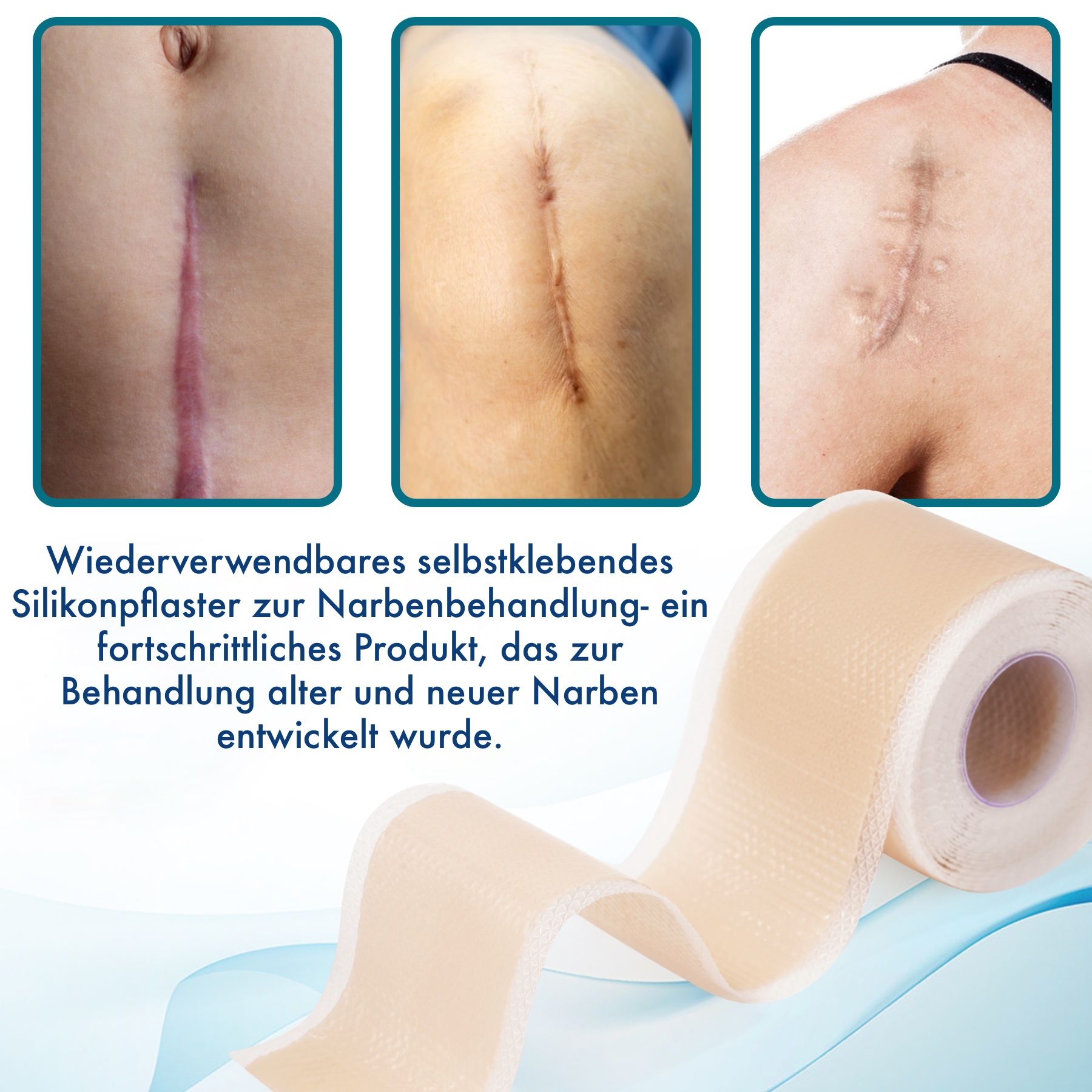 Siliconenpleisterrol voor de behandeling van oude en nieuwe littekens.
