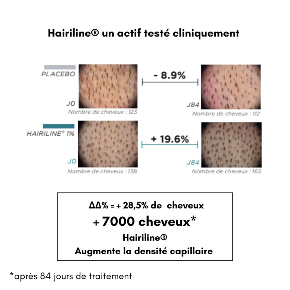 Comparaison de la croissance des cheveux. Placebo vs. Hairiline 1%. Diagramme montrant l'évolution de la densité capillaire. Texte: +28,5% de cheveux.