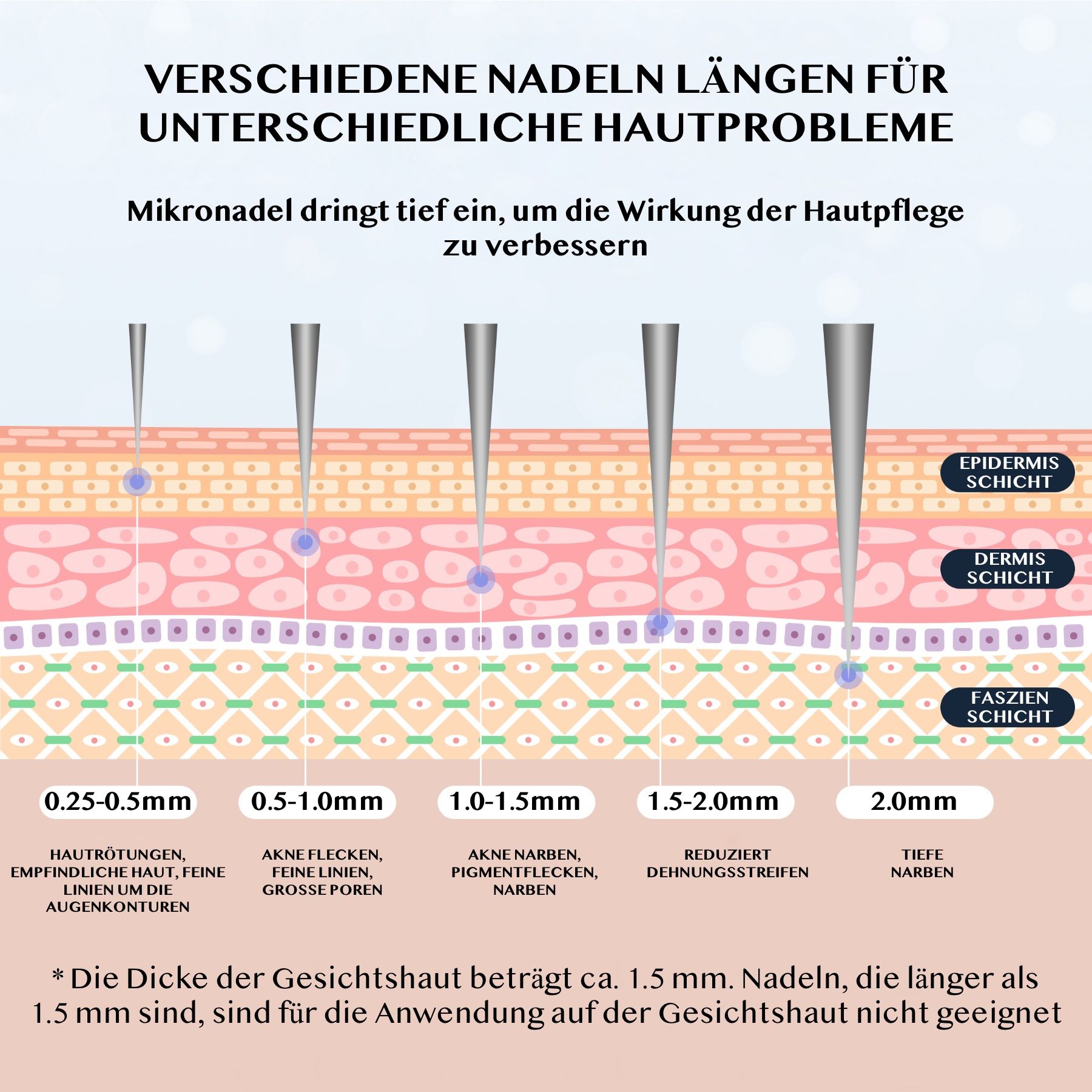 Illustratie toont verschillende naaldlengtes (0.25-2.0mm) voor huidproblemen zoals roodheid, acne en littekens.