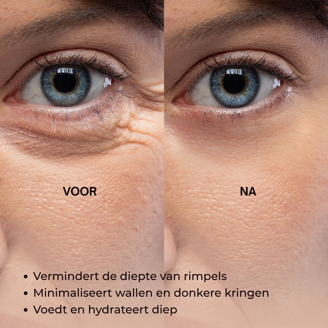 Voor-en-na foto van ogen. Verminderde rimpels, minimaliseert wallen. Tekst: Anti-Aging Face Serum.