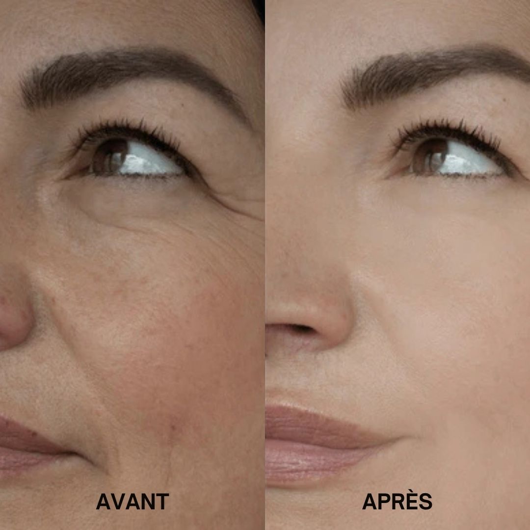 Comparaison avant-après de la peau. Gauche : peau ridée. Droite : peau lisse. Aucune désignation de produit visible.