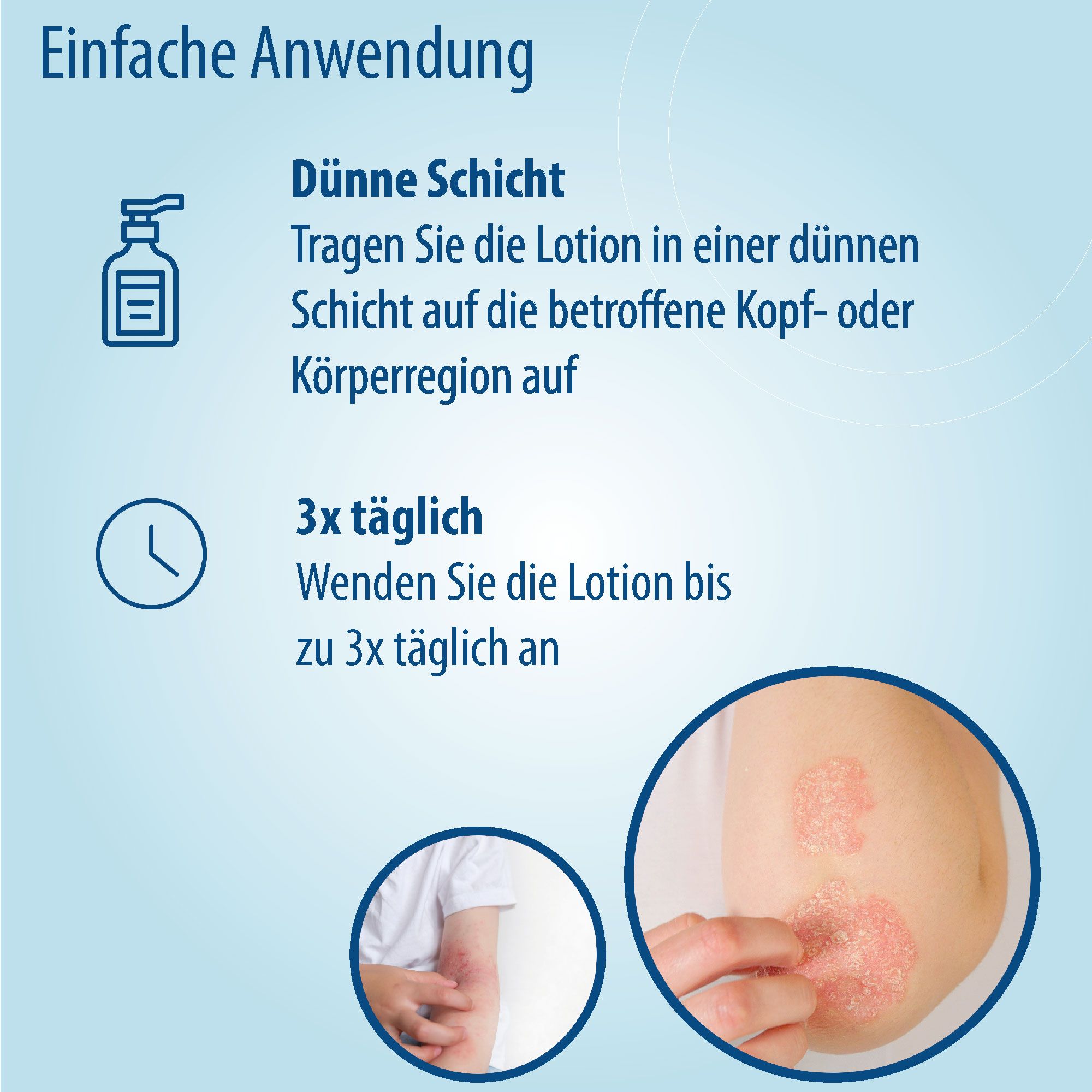 Graphique: Application de la lotion. Texte: Couche fine, 3x par jour. Montré: Peau avec eczéma. Appliquer la lotion.