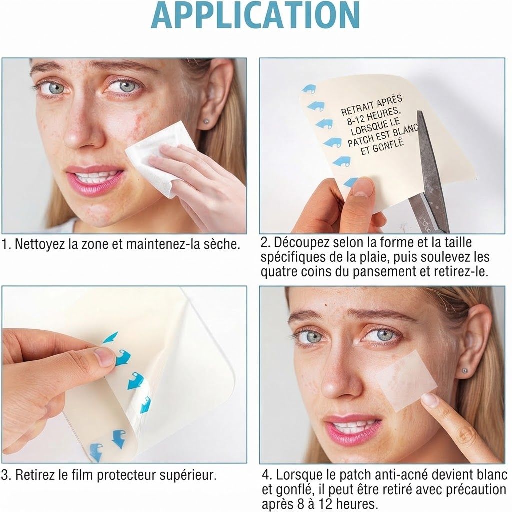 Instructions d'application pour patchs anti-acné : nettoyer la peau, découper le patch, retirer le film protecteur, appliquer.