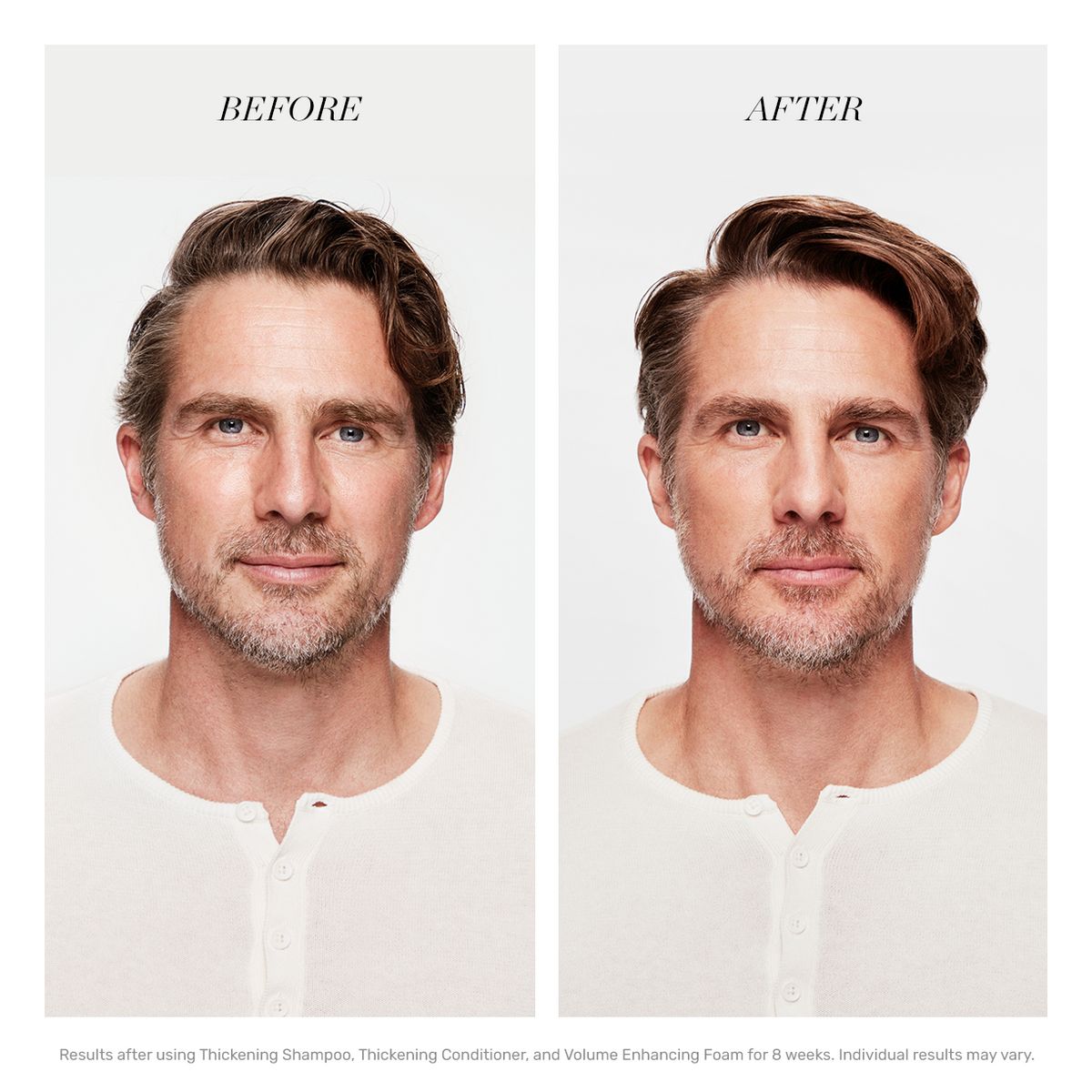 Voor/na-vergelijking. Man met haar. Teksten: « BEFORE » en « AFTER ». Resultaten na 8 weken met shampoo, conditioner en schuim.