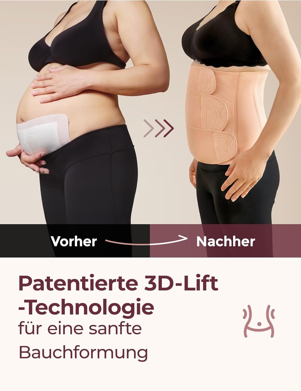 Voor-en-na vergelijking: buikvorming met post-partum buikband.