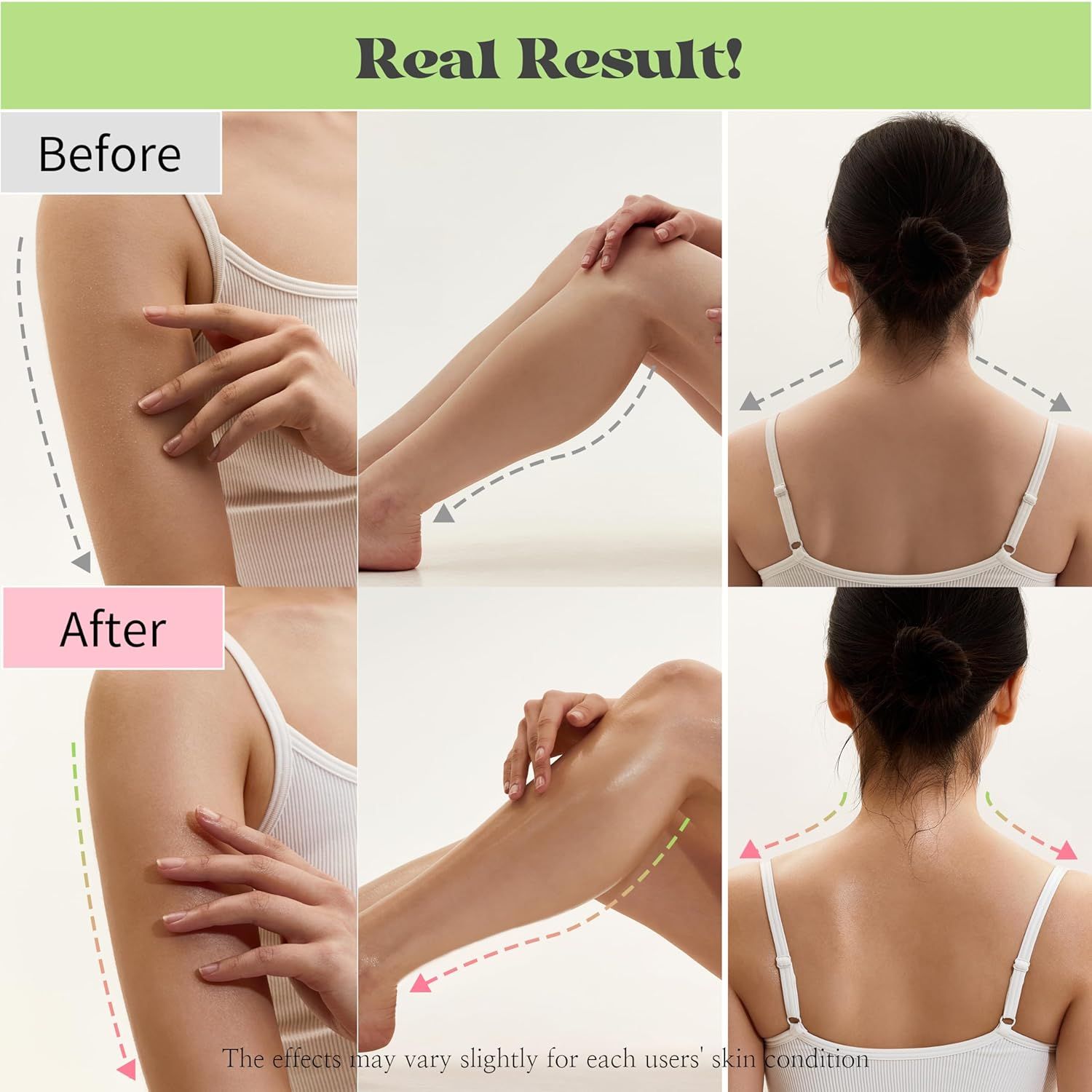 Images avant-après de parties du corps. Des flèches indiquent les changements. Texte : Résultat réel ! Les effets peuvent varier.