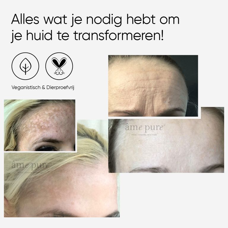 Oudere vrouw die WrinklEraser gel fles vasthoudt, huidproblemen tonend.