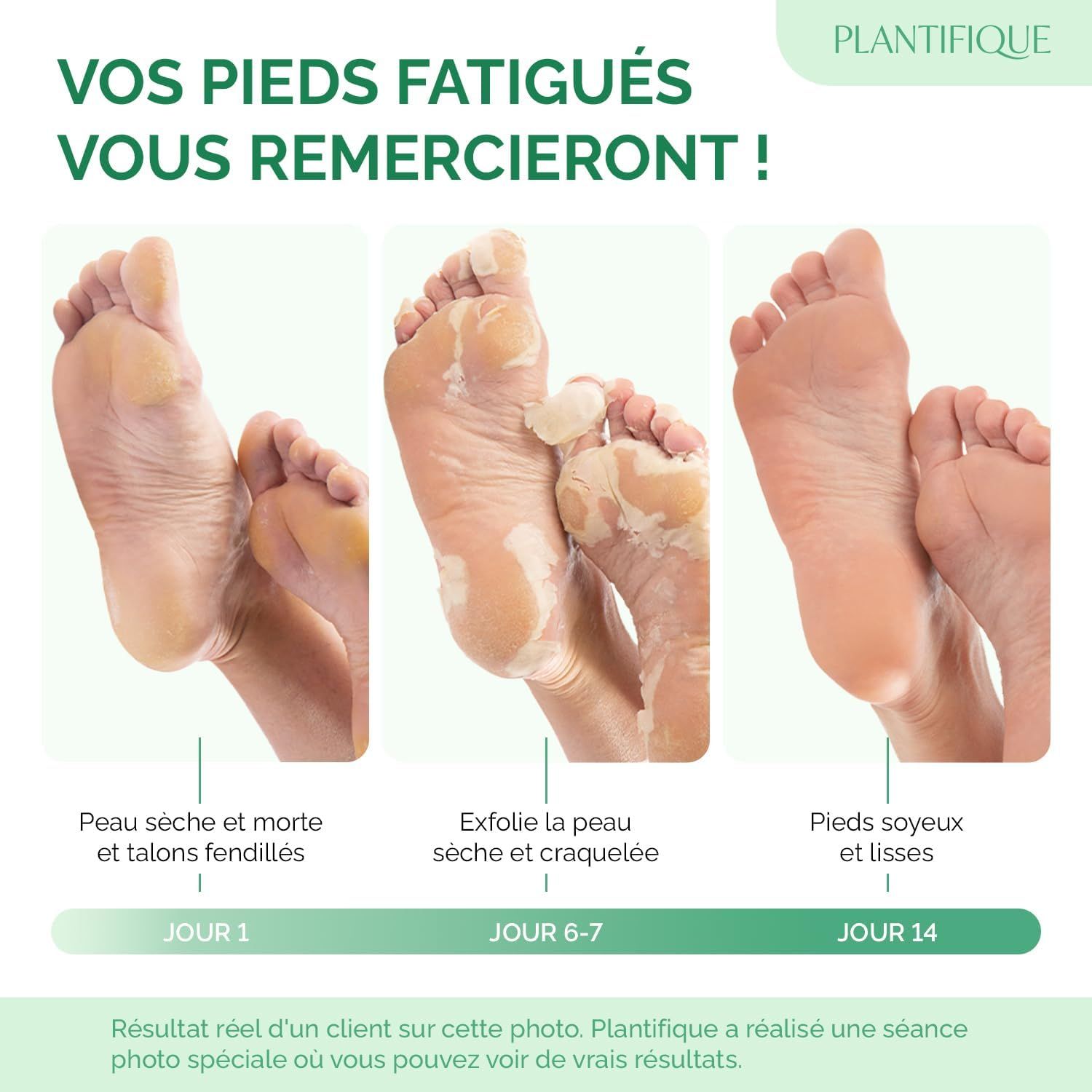 Progression de l'exfoliation des pieds : peau sèche, pelage, peau lisse.