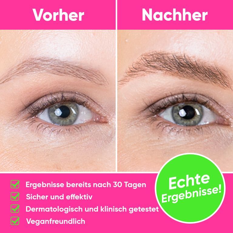 Voor-en-na vergelijking van wenkbrauwen. Resultaten na 30 dagen.