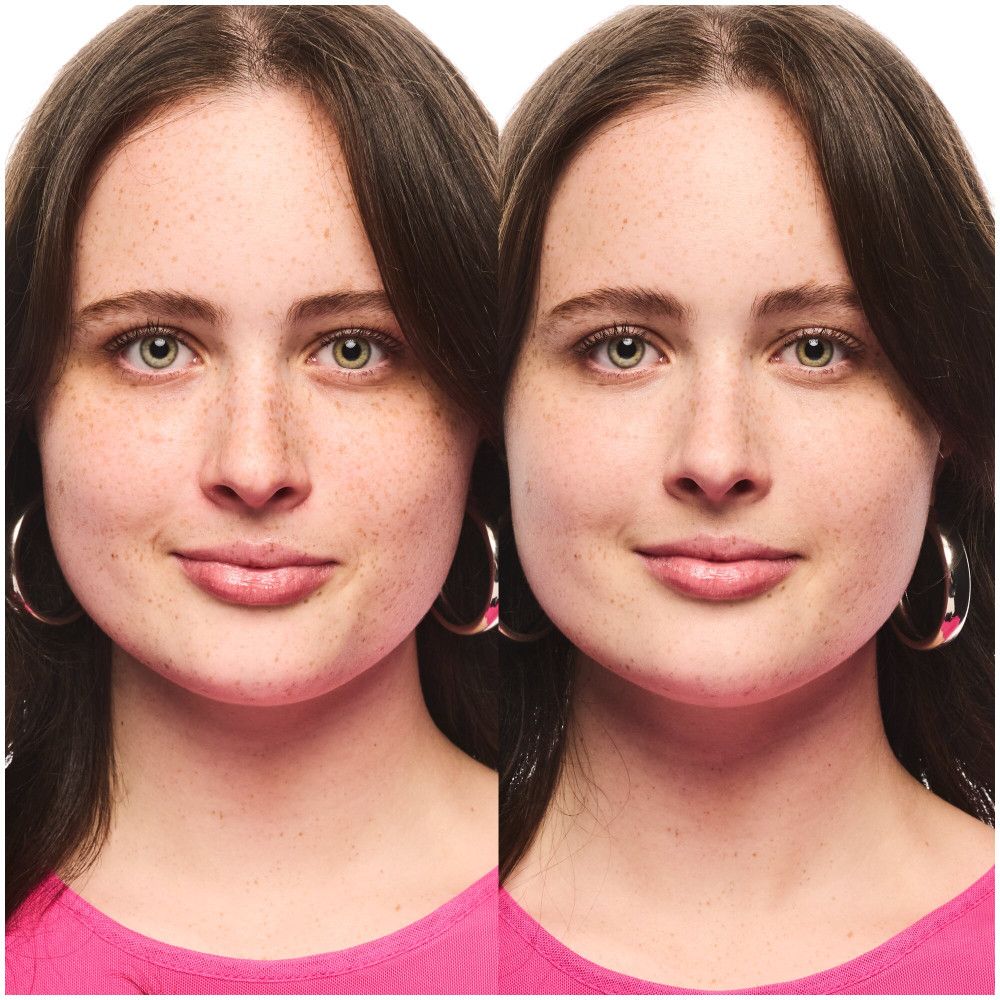 Comparaison de deux visages. Gauche : visage avec taches de rousseur. Droite : visage sans taches de rousseur. Les deux portent des boucles d'oreilles.