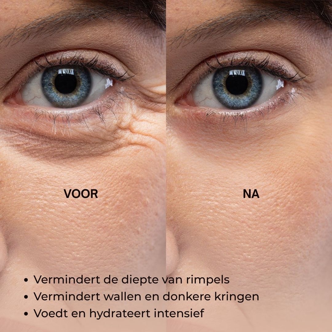 Voor-en-na-afbeelding. Oogcontour met rimpels en wallen. Na: minder rimpels, minder wallen, intensieve hydratatie.