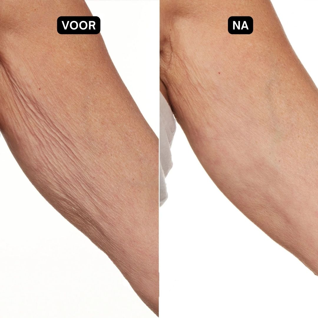 Blauw-witte crème tube. Tekst: Dr. SEA, Detox & Lifting Body Cream. Bevat fytosterolen & resveratrol.