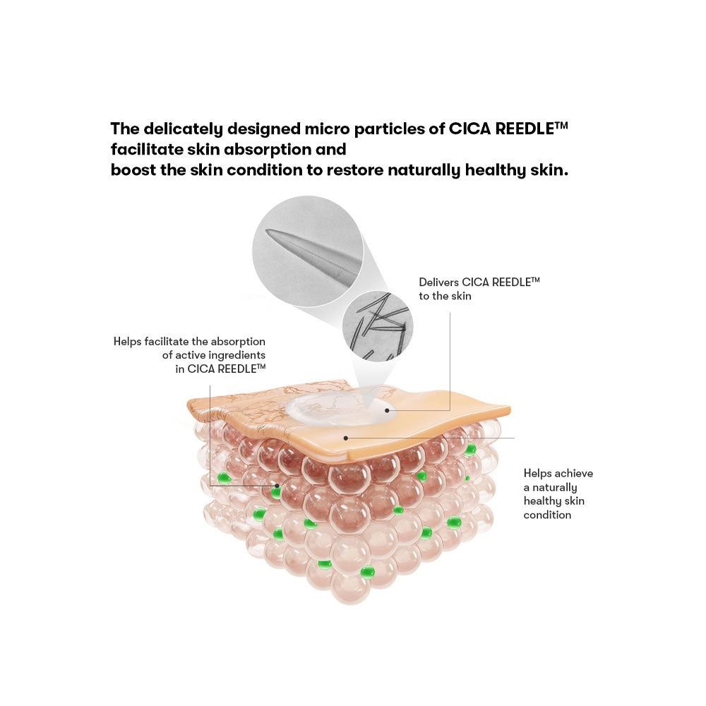 Afbeelding met huidlagen. Micronaalden, actieve ingrediënten en hun effect op de huid.