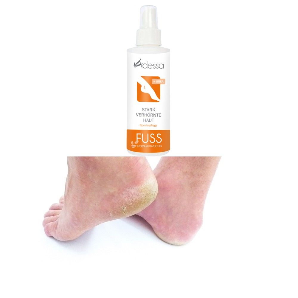 Flacon spray blanc avec étiquette au-dessus des pieds. Graphique orange avec pied. Texte: Adessa, peau très cornée, pied, adoucissant callosités.