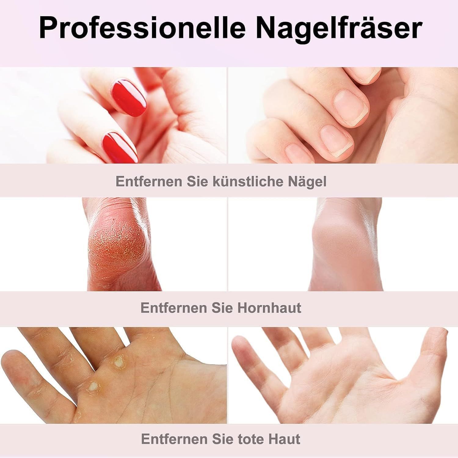 Collage montrant des mains et des pieds avant et après le traitement des problèmes d'ongles et de callosités.
