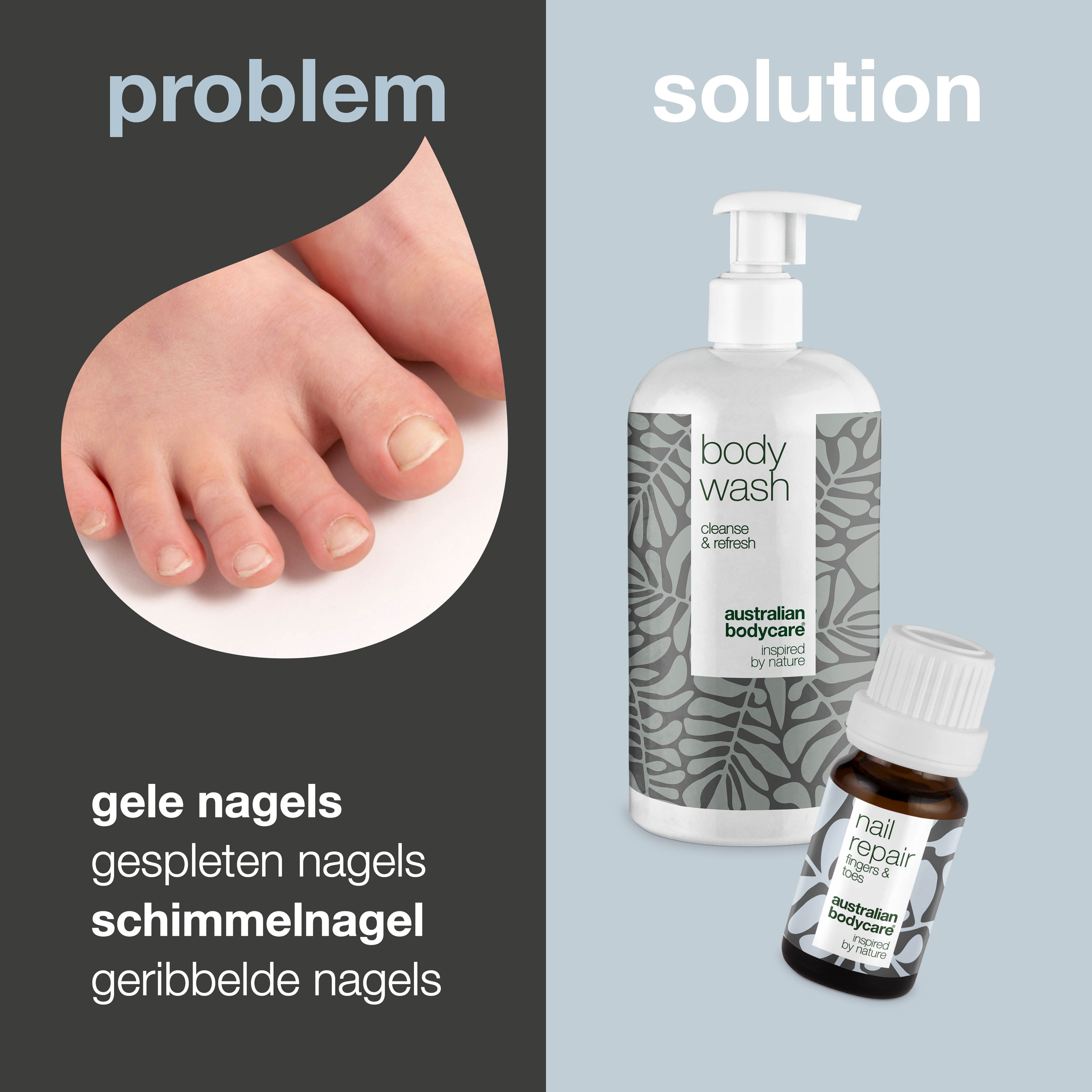Vergelijking problemen en oplossingen. Gele nagels, schimmel, geribbelde nagels. Body wash en nagelolie.