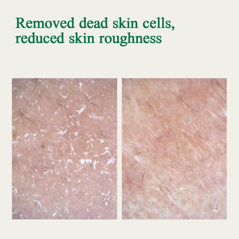 Comparaison avant-après de la texture de la peau, montrant une rugosité réduite.