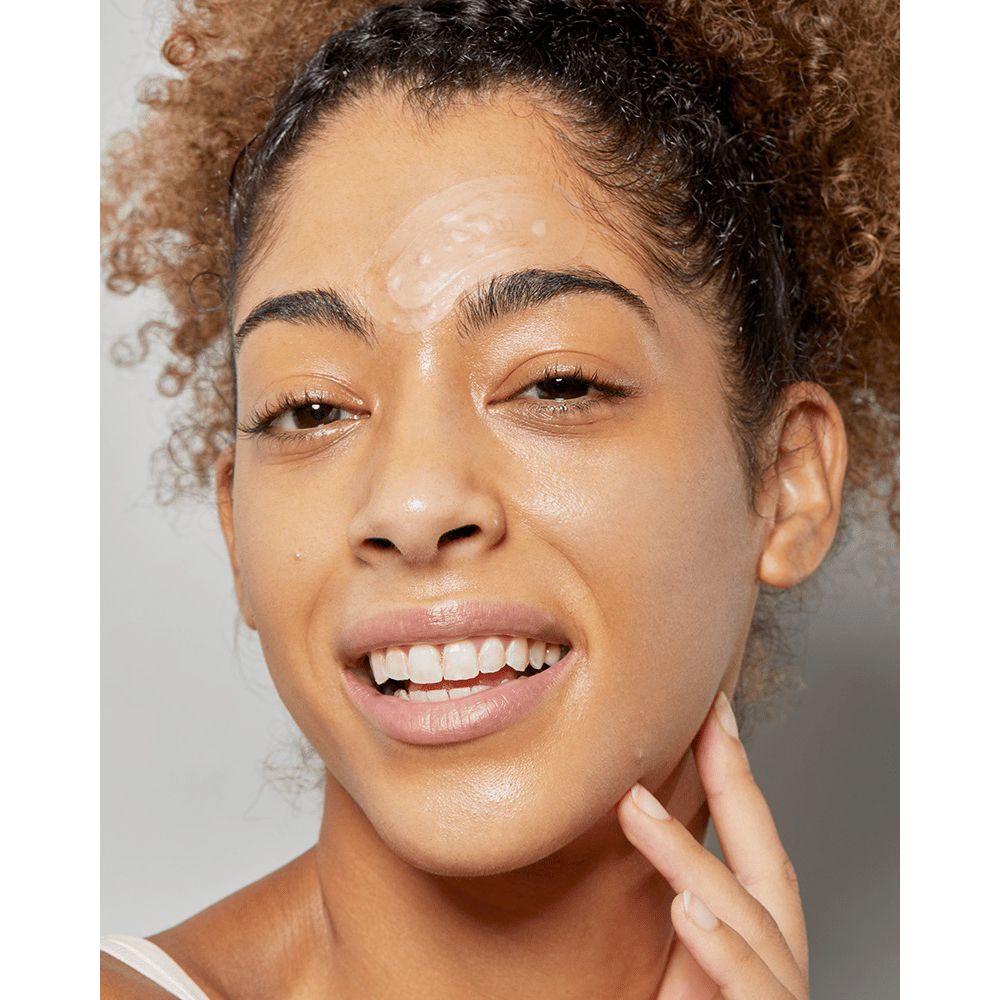 Gros plan d'une personne avec un patch anti-acné sur la joue. La personne sourit. La peau est brillante.