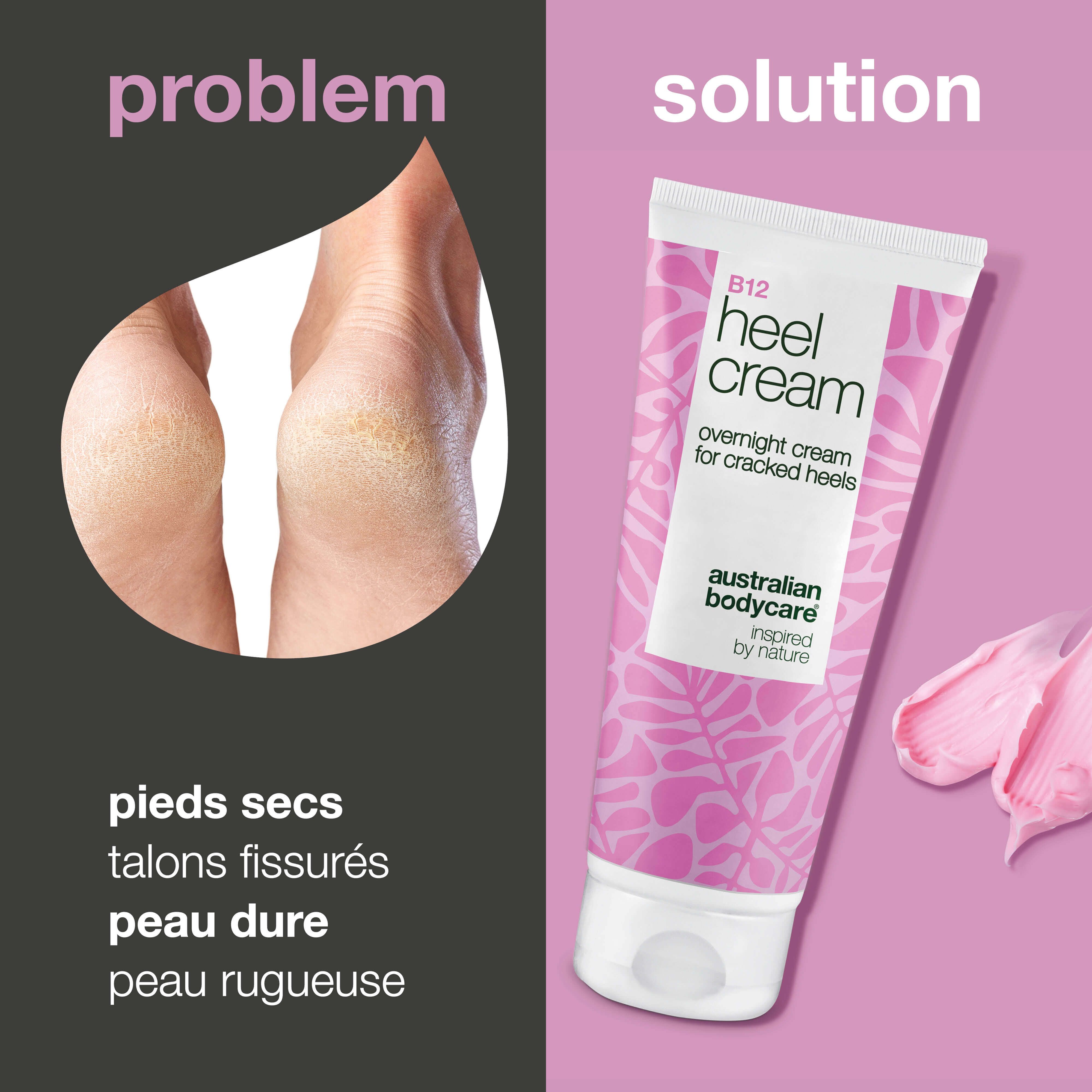 Tube de crème B12 Heel Cream. Design rose et blanc avec motif floral. Inscription : overnight cream for cracked heels.