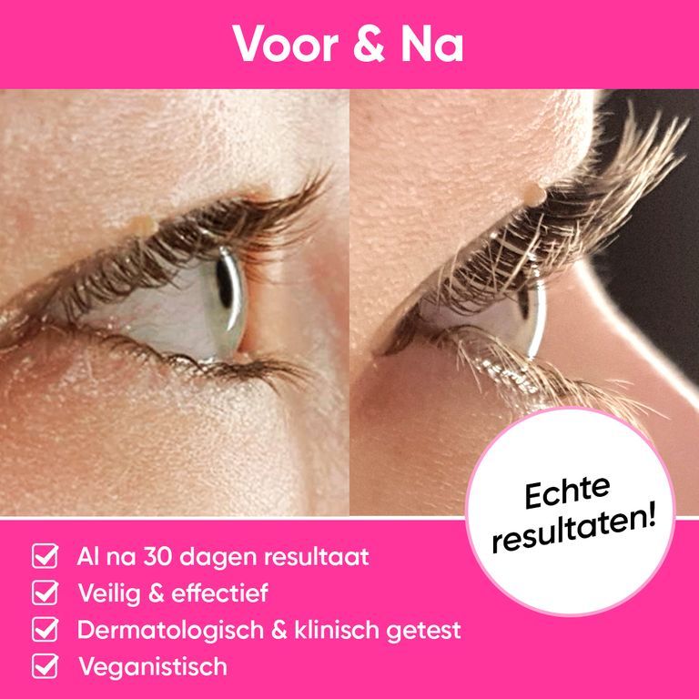 Voor-en-na vergelijking van wimpers behandeld met LUXE LASH wimperserum. Toont vollere, langere wimpers.