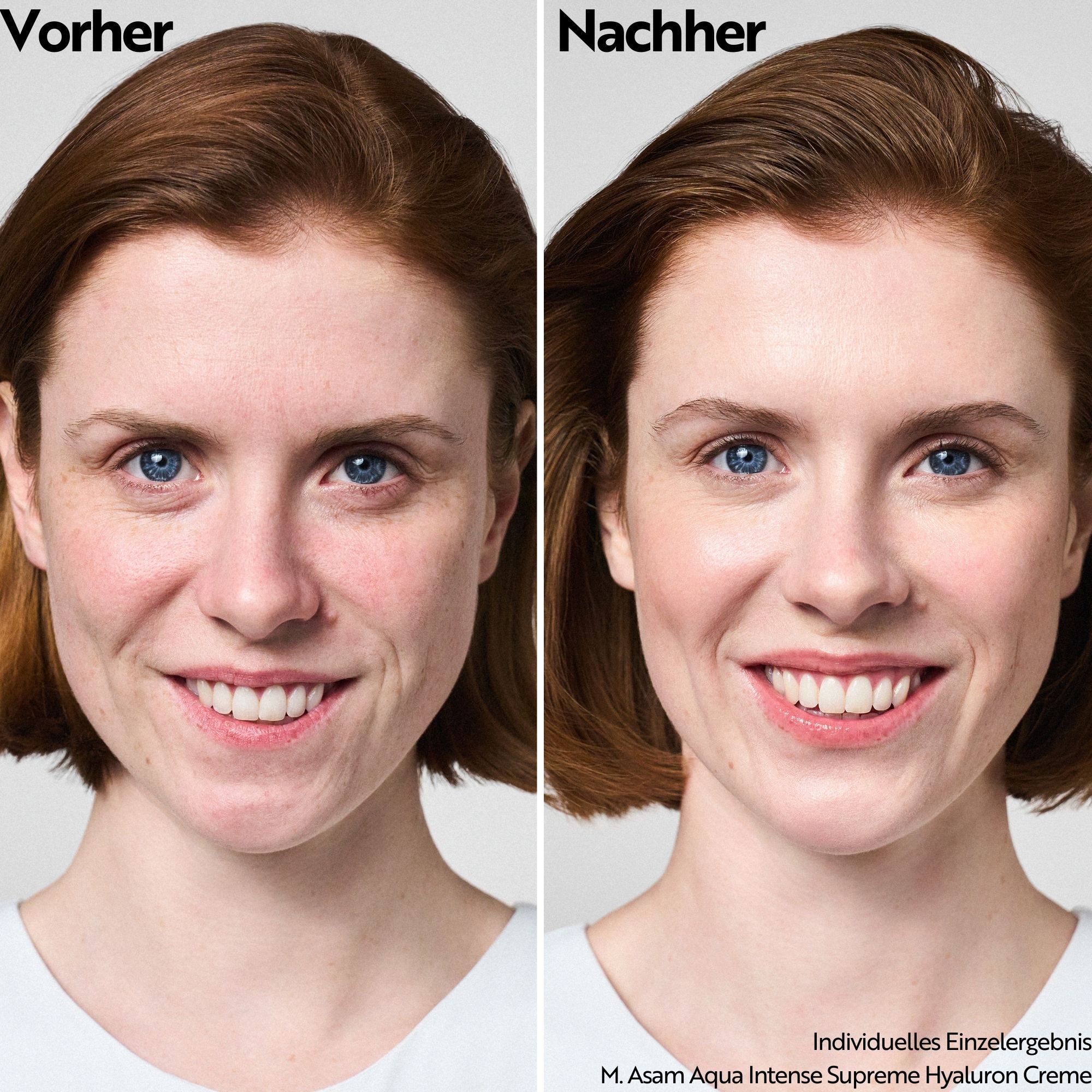 Aqua Intense Supreme Hyaloúron Cream