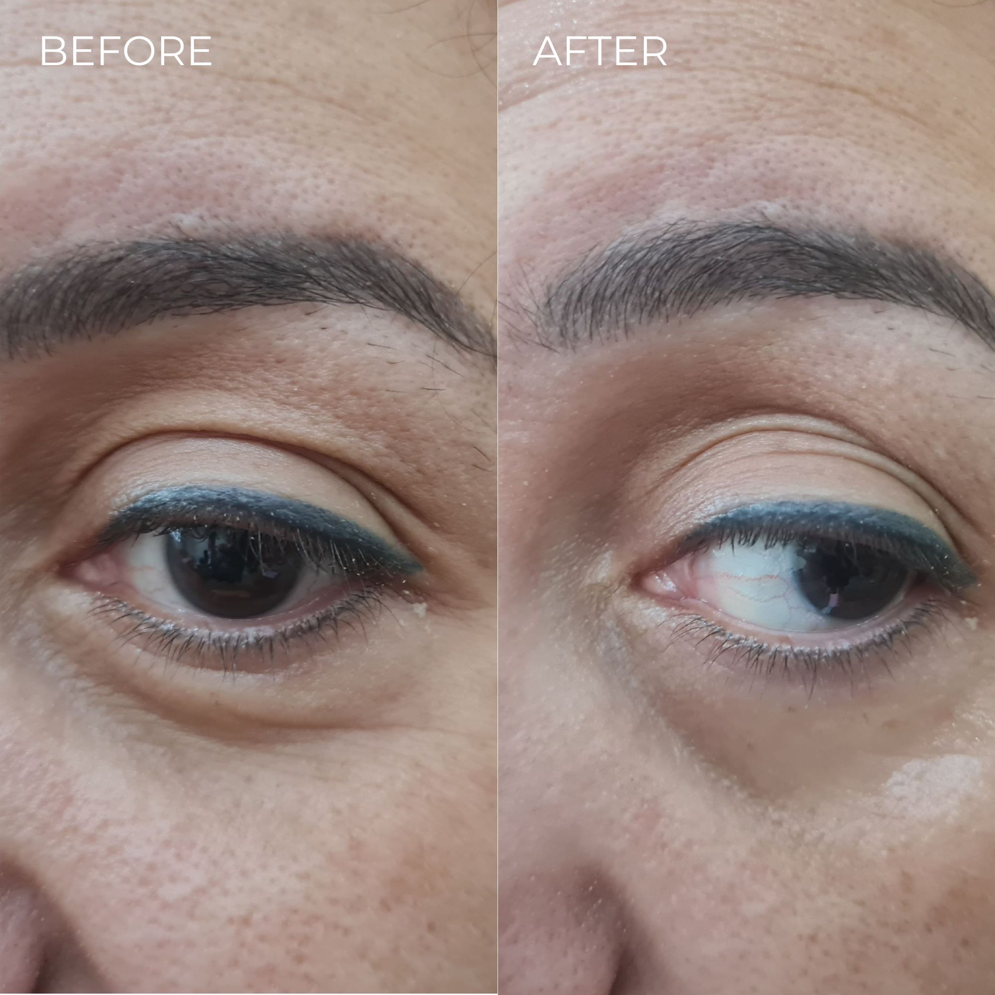 BEAUTICAL Instant Lifting Serum