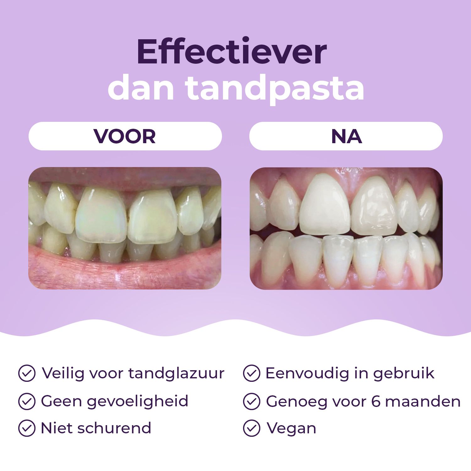 Voor-en-na-vergelijking van tanden. Voordelen: veilig, geen gevoeligheid, niet-schurend, veganistisch.