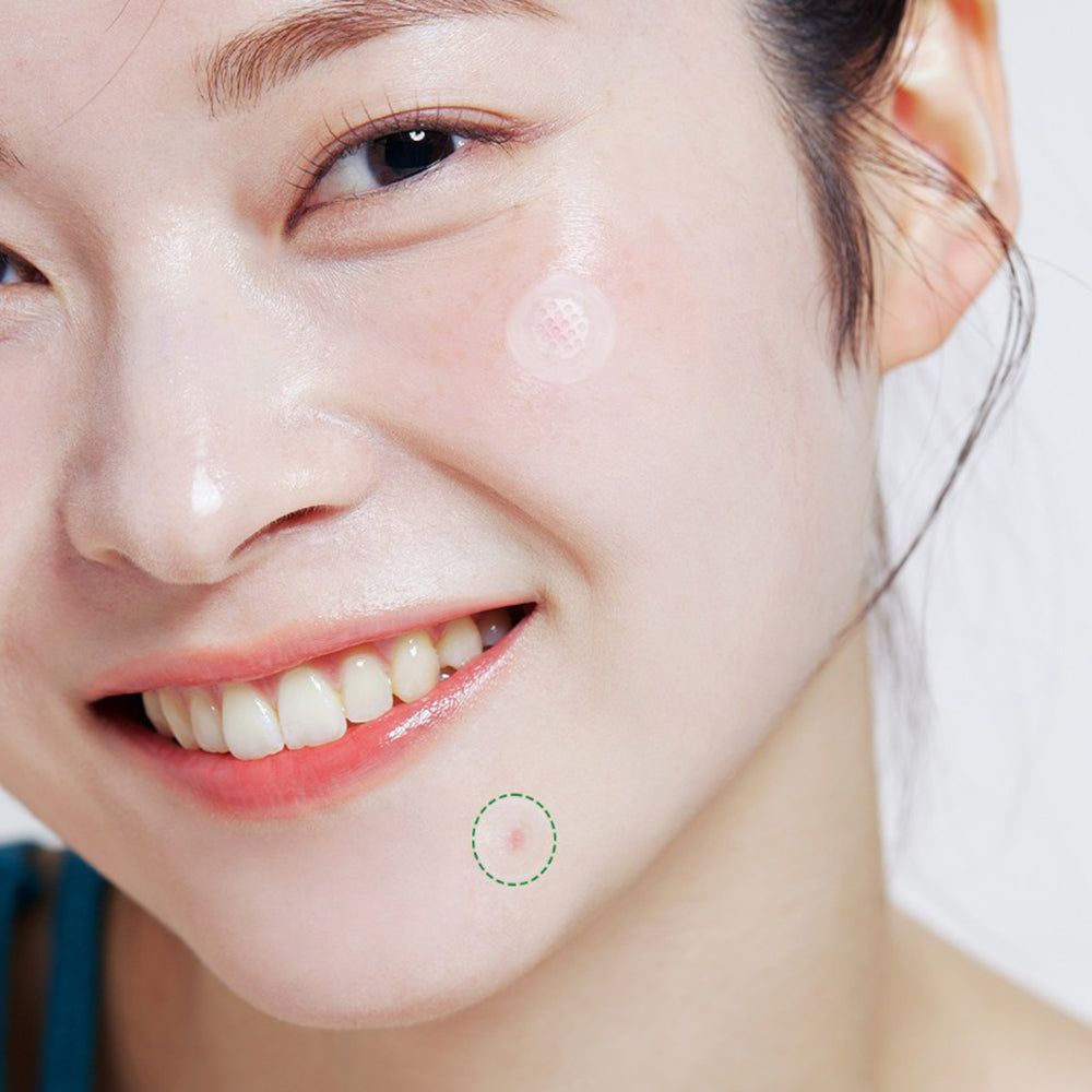 ACROPASS Trouble Care Microcone-pleisterset
