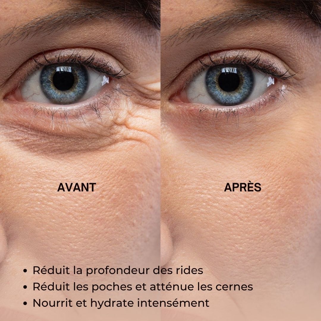 Avant-après des yeux. Rides réduites, cernes minimisées. Texte : Anti-Aging Face Serum.