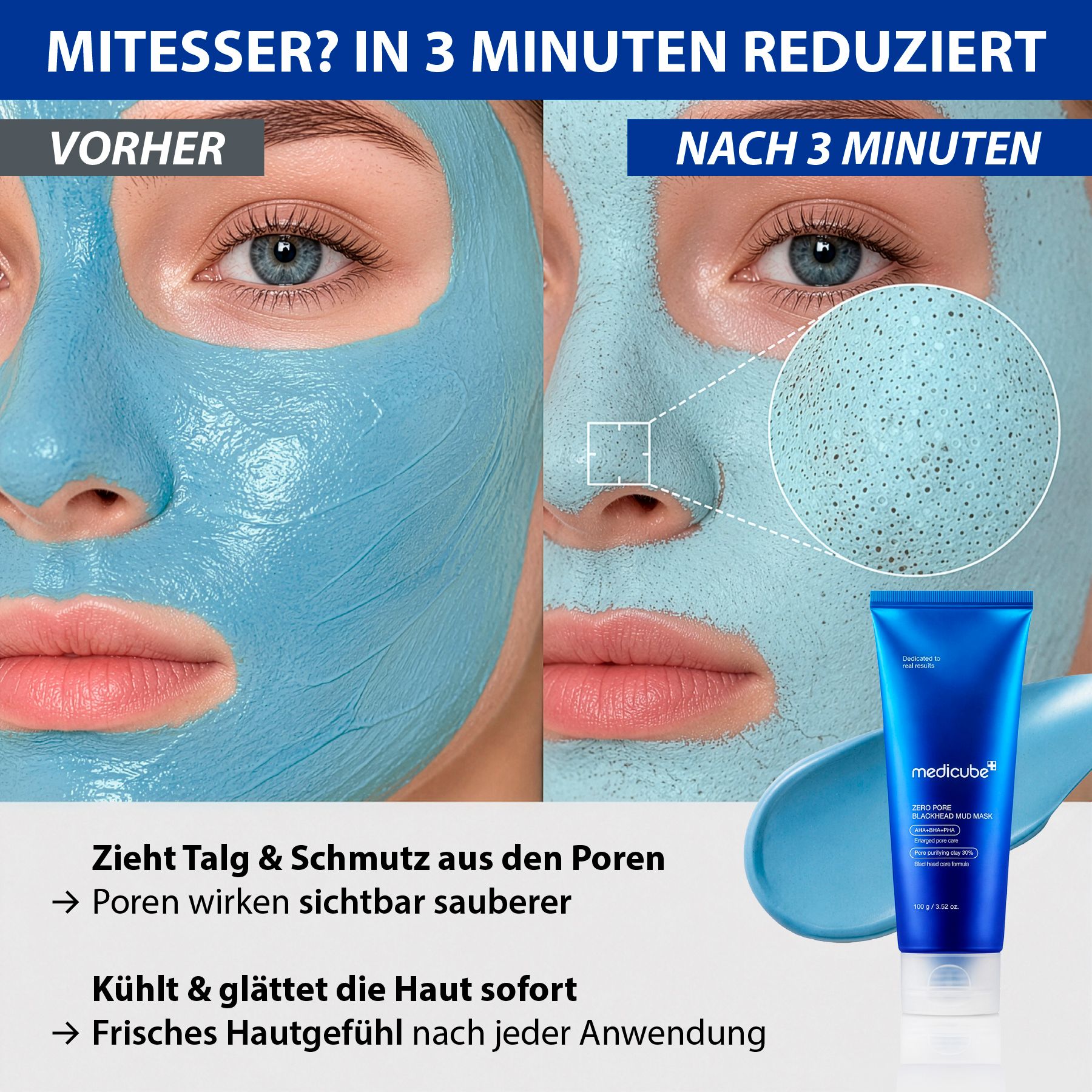 Comparaison avant-après d'un masque facial montrant une crème bleue. Une loupe met en évidence les pores.