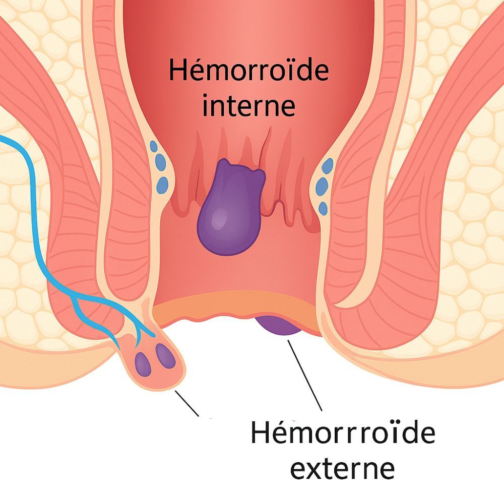 500Cosmetics Crème Hemapro contre les hémorroïdes