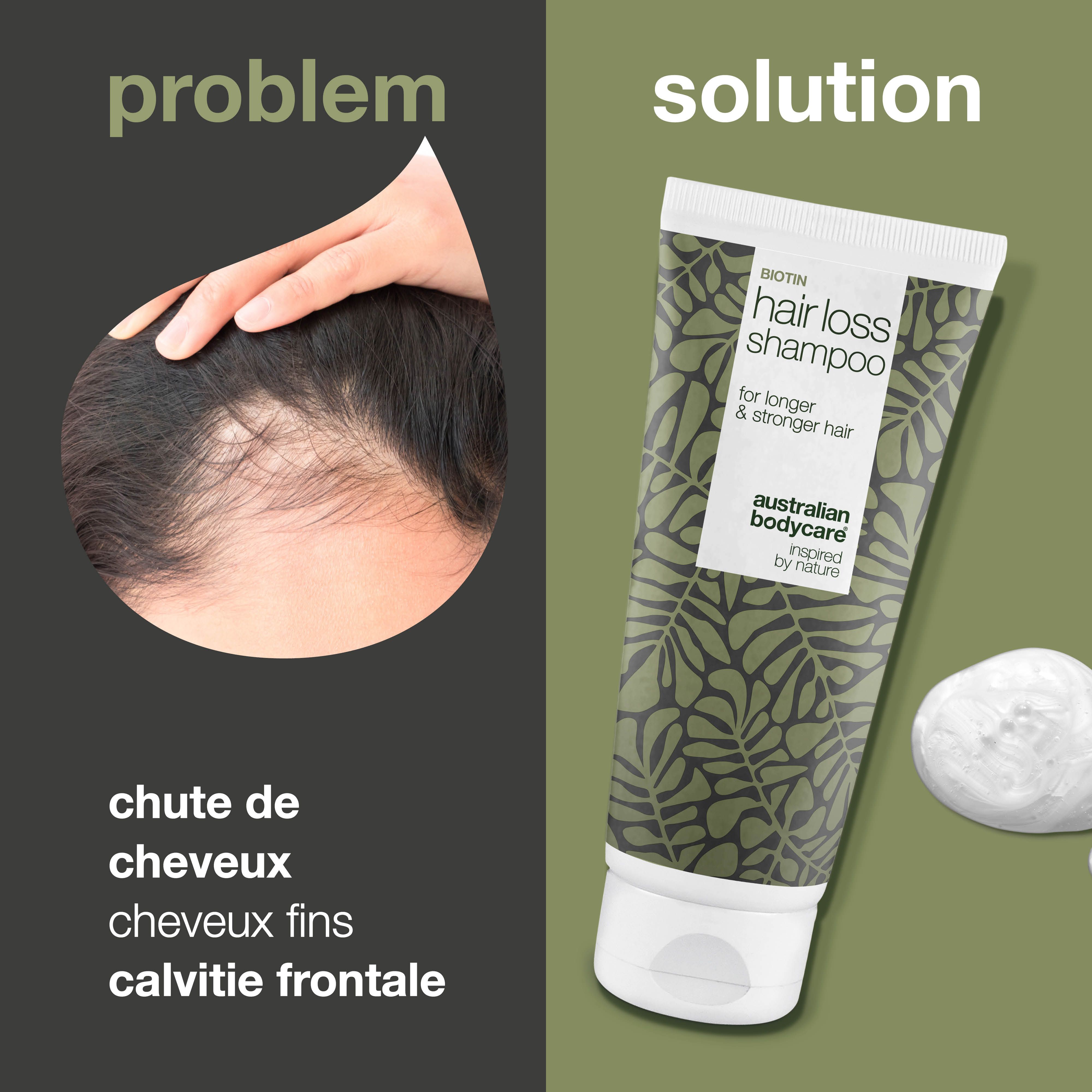 Tube de shampooing Biotin Hair Loss. Design vert et blanc. Texte: Hair Loss Shampoo, Australian Bodycare.