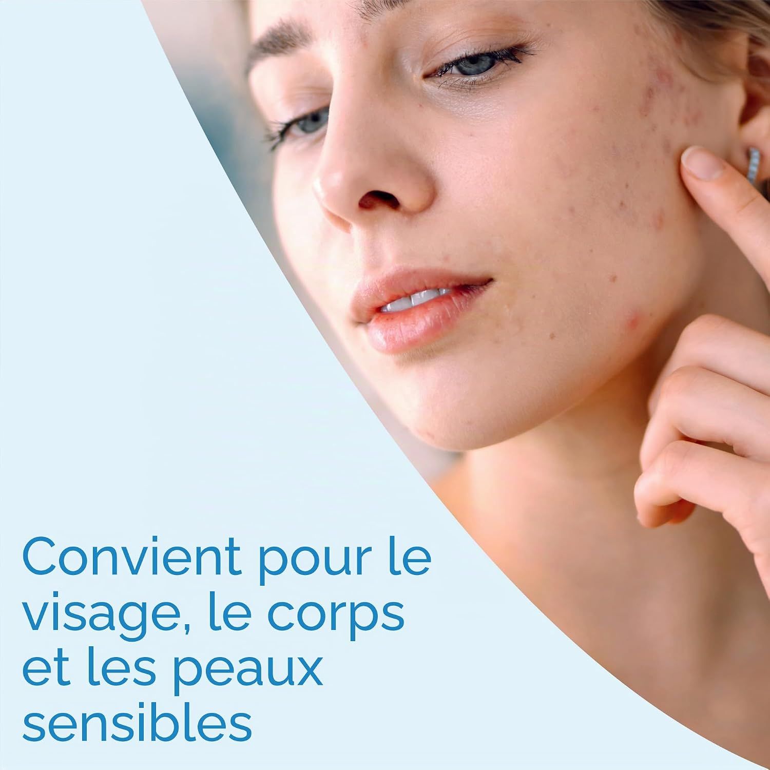 Jeune femme avec acné touchant sa peau. Kelo-Cote convient au visage et aux peaux sensibles.