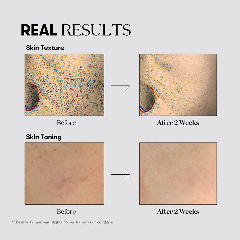VT COSMETICS TX-Toning: Voor-en-na vergelijking van huidtextuur en teint.