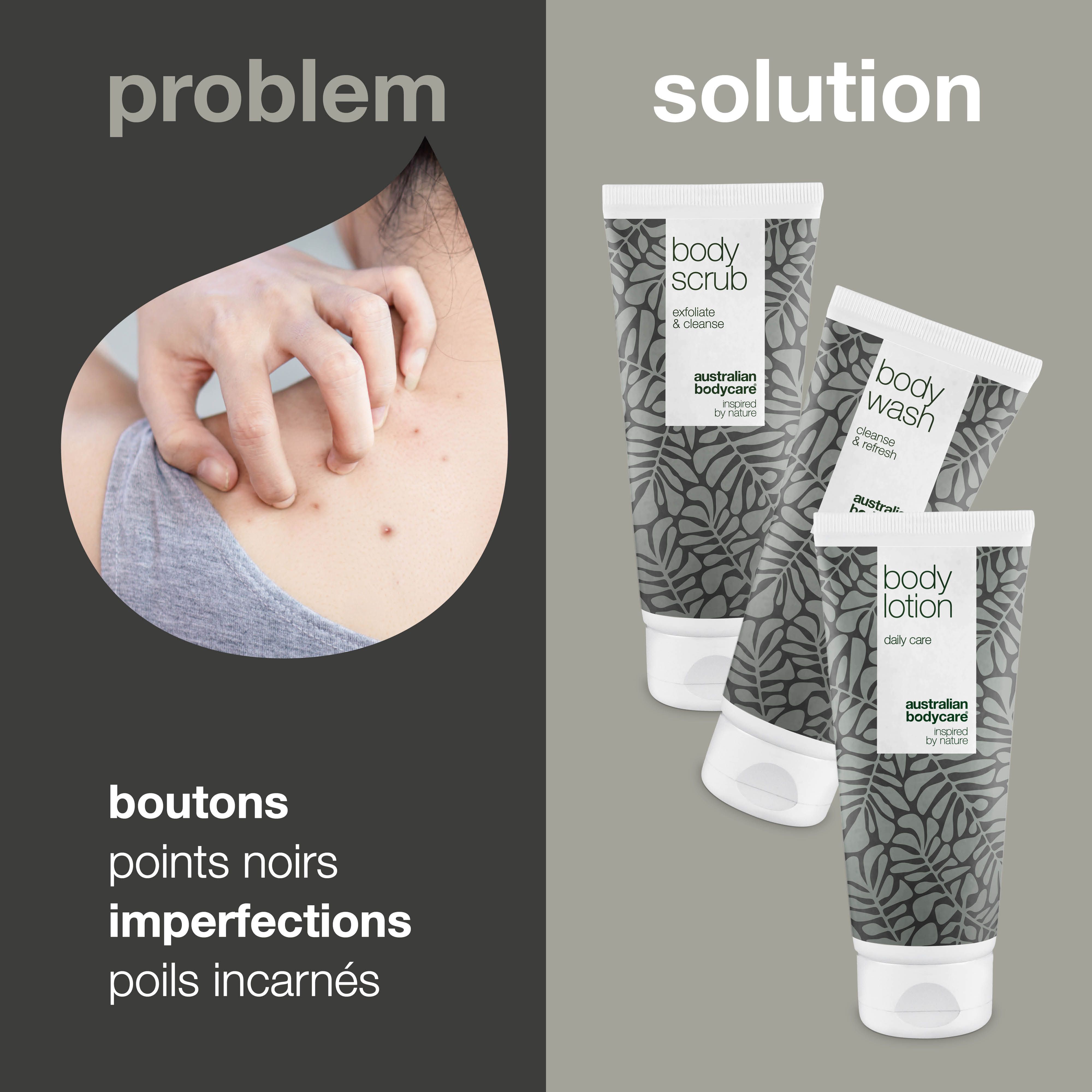 Problème : boutons, points noirs, poils incarnés. Solution : trois tubes de produits pour le corps.