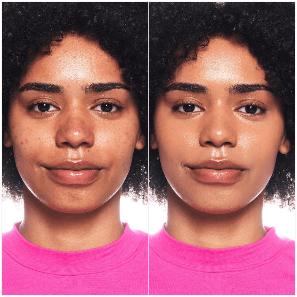 Deux visages. Gauche : imperfections cutanées. Droite : peau avec fond de teint. Les deux femmes portent un haut rose.