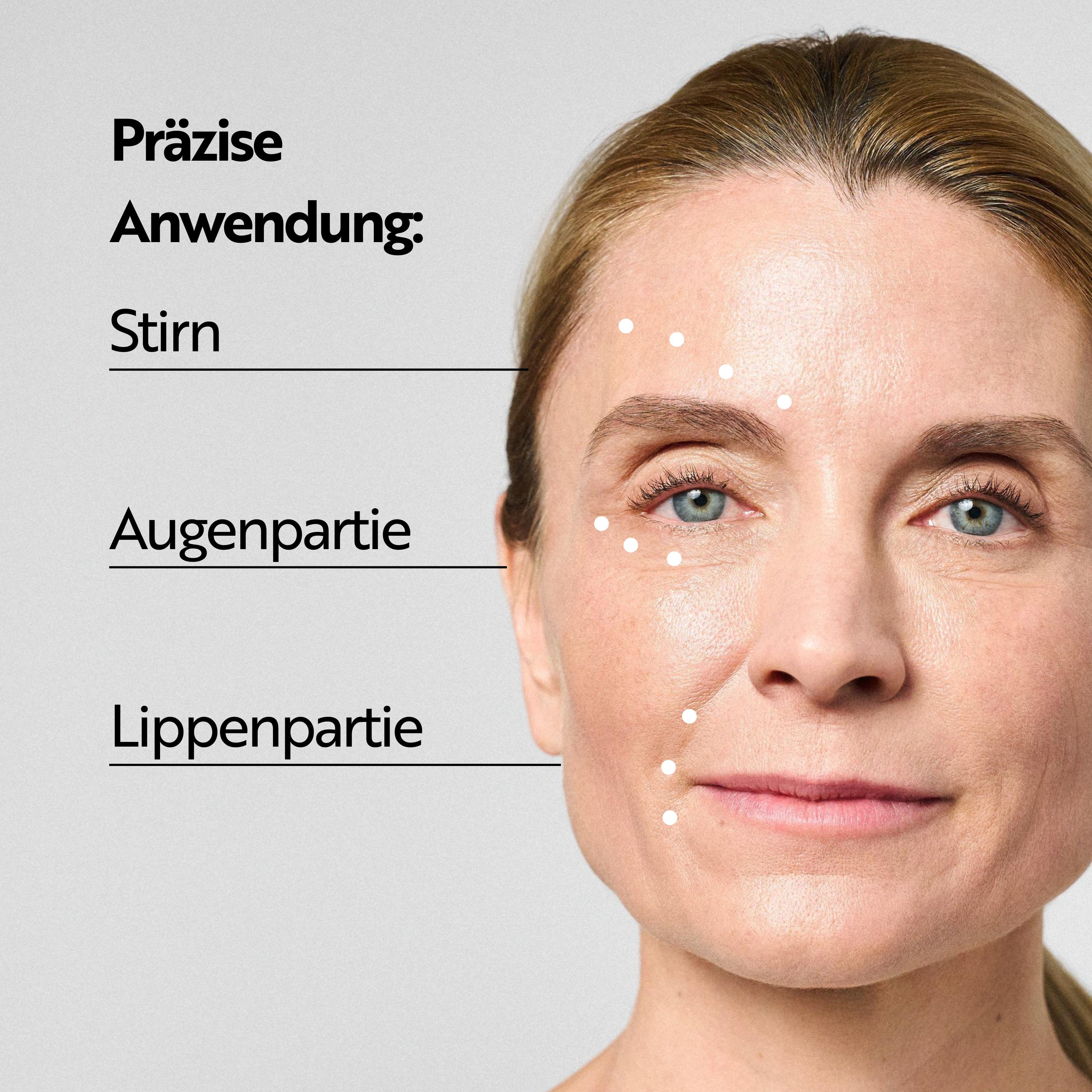 Gezicht van een vrouw met punten voor precieze toepassing. Gebieden: voorhoofd, oogcontour, lippen.