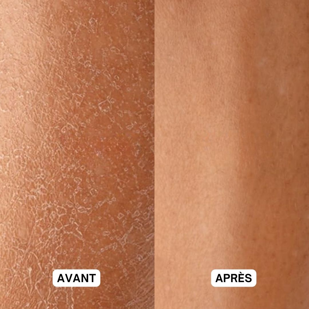 Comparaison avant-après. Peau sèche avant utilisation. Peau lisse après utilisation.